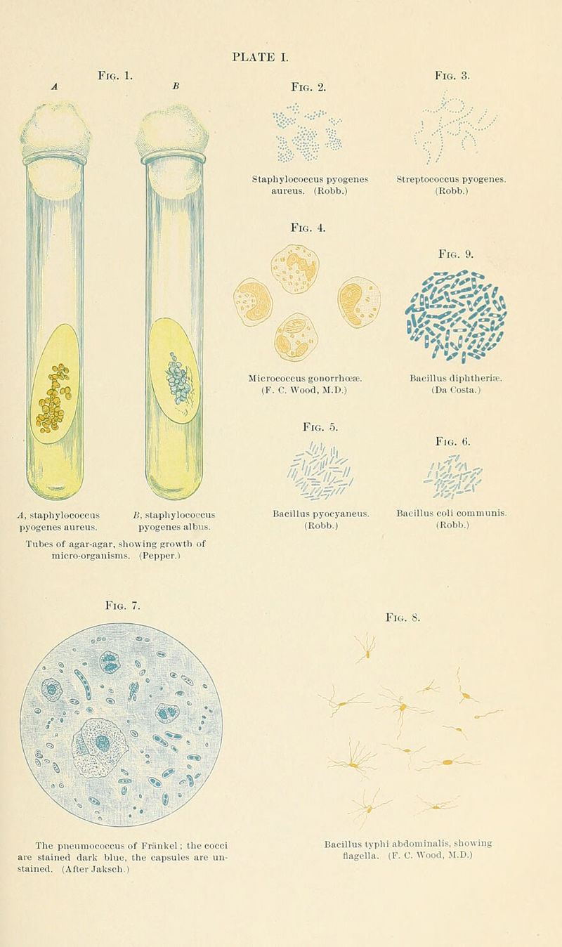 A, staphylococcas pyogenes aureus. B, staphylococcus pyogenes albus. Tubes of agar-agar, showing .e:rowth of micro-organisms. (Pepper.l Fig. 7. staphylococcus pyogenes aureus. (Robb.) Micrococcus gonorrhceee. (F. C. Wood, M.D.) Bacillus pyocyaneus. (Robb.) Streptococcus pyogenes. (Robb.) Fig. 9. Bacillus cliphtberiK. (Da Costa.) Fig. 6. Bacillus coli comu (Robb.) The pneumococcus of Friinkel; the cocci are stained dark blue, the capsules are un- stained. (After Jaksch.) Bacillus typhi abdominalis, showing flagella. (F. C. Wood, M.D.)