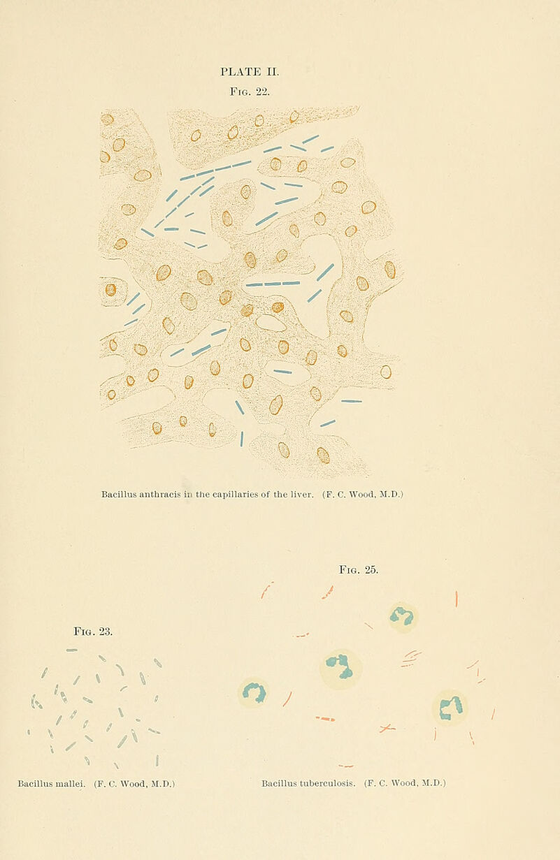 Pig. 22. / / ^ :. ^ o ■. 0 0 Bacillus anthracis in tlie capillaries of tlie liver. (F. C. Wood, M.D.) Fig. 25. Fig. 23. _. ^ ' \ V ^ .\ ^ ^ ) \ ^ ^ I Bacillus mallei. (F. C. Wood, M.D.) Bacillus tuberculosis. (F. C. Wood, M.D.)