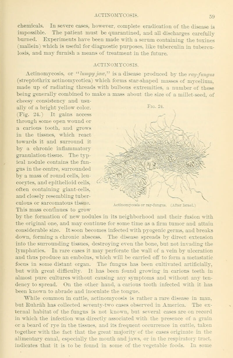 chemicals. In severe cases, however, complete eradication of the disease is impossible. The patient must be qnarantined. and all discharges carefollv bnmed. E3rperiments have been made with a sermn containing the toxines (mallein; which is xisefol for diagnostic purposes, lite tuberculin in tubercu- losis, and may furnish a means of treatment in the future. ACTIiSrOMTCOSlB. Actinomycosis, or •'Imapyjaw. is a disease produced bj ih& ray-fungm (streptothrix actinomycotica) which forms star-shaped masses of mycelium, made up of radiating threads with bnll:»ous extremities, a number of th^e being generally combined to make a mass about the size of a millet-seed, of cheesy consistency and usu- ally of a bright yellow color. Tig. 24. (Fig. 24.) It gains access ,.^ \ through some open wound or ^^ «^ / a carious tooth, and grows - _._ in the tissues, which react -^ — towards it and surround it by a chronic inflammatory ~^-v ^^ granulation-tissue. The typ- _^,,? t- i^- ical nodule contains the fan- i^- gus in tlie centre, surrounded  i^?-**;: -'' *%' by a mass of round cells, leu- ' cocytes. and epithelioid c-ells, ^- ^~ > . J^, often containing giant-c-ells. ^ ~ - and closely resembling tul>er- ■''->~~- -' ^'-'--^ V CUIOUS or sarcomatous tissue. AeliB«iByecior3aT-feEgiL^ (Afterfeiae!.) This mass continues to grow by the formation of new nodules in its neighborhood and their fusion with the original one. and may continue for some time as a firm tumor and attain considerable size. It soon becomes infected with pyogenic germs, and breaks dowxL forming a chronic absc^s. The disease spreads by direct extension into the surix>unding tissues, destroying even the bone, but not invading the lymphatics. In rare cases it may perforate the wall of a vein by ulceration and thus produce an embolus, which will be c-arried off to form a metastatie focus in some distant organ. The fongus has been ctdtivated artificially, but with great difficulty. It has been found growing in c-ariotis teeth in almost pure cultures without catising any symptoms and without any ten- dency to spread. On the other hand, a carious tooth infected with it has been known to abrade and inoculate the tongue. While common in cattle, actinomycosis is rather a rare disease in man, but Euhrah has collected seventy-two cases observed in America. The ex- ternal habitat of the fungus is not known, but several cases are on record in which the infection was directly associated with the presence of a gi-ain or a beard of rye in the tissues, and its frequent occurrence in cattle, taken together with the fact that the great majority of the eases originate in the alimentary canal, especially the mouth and jaws, or in the respiratory tract, indicates that it is to be found in some of the vegetable foods. In some