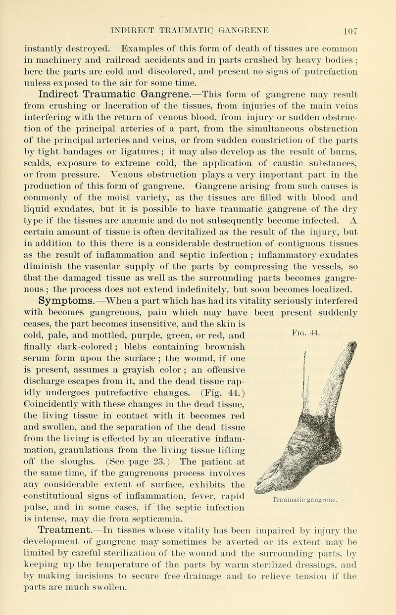 instantly destroyed. Examples of this form of death of tissues are eommou in machinery and railroad accidents and in parts crushed by heavy bodies ; here the parts are cold and discolored, and present no signs of putrefaction unless exposed to the air for some time. Indirect Traumatic Gangrene.—This form of gangrene may result from crushing or laceration of the tissues, from injuries of the main veins interfering with the return of venous blood, from injury or sudden obstruc- tion of the principal arteries of a ijart, from the simultaneous obstruction of the principal arteries and veins, or from sudden constriction of the parts by tight bandages or ligatures ; it may also develop as the result of burns, scalds, exposure to extreme cold, the application of caustic substances, or from pressure. Veuous obstruction plays a very important part in the production of this form of gangrene. Gangrene arising from such causes is commonly of the moist variety, as the tissues are filled with blood and liquid exudates, but it is possible to have traumatic gangrene of the dry type if the tissues are anaemic and do not subsequently become infected. A certain amount of tissue is often devitalized as the result of the injury, but in addition to this there is a considerable destruction of contiguous tissues as the result of inflammatiou and septic infection; inflammatory exudates diminish the vascular supply of the parts by compressing the vessels, so that the damaged tissue as well as the surrounding parts becomes gangre- nous ; the process does not extend indefinitely, but soon becomes localized. Symptoms.—When a part which has had its vitality seriously interfered with becomes gangrenous, pain which may have been present suddenly ceases, the part becomes insensitive, and the skin is cold, pale, and mottled, purple, green, or red, and finally dark-colored; blebs containing brownish serum form upon the surface; the wound, if one is present, assumes a grayish color; an offensive discharge escapes from it, and the dead tissue rap- idly undergoes putrefactive changes. (Fig. 44.) Coincidently with these changes in the dead tissue, the living tissue in contact with it becomes red and swollen, and the separation of the dead tissue from the living is effected by an ulcerative inflam- mation, granulations from the living tissue lifting off the sloughs. (See page 23.) The patient at the same time, if the gangrenous process involves any considerable extent of surface, exhibits the constitutional signs of inflammation, fever, rapid pulse, and in some cases, if the septic infection is intense, may die from septicnemia. Treatment.—In tissues whose vitality has been impaired by iujm-y the development of gangrene luay sometimes be averted or its extent may be limited by careful sterilization of the wound and the surrounding parts, by keeping up the temiierature of the parts by warm sterilized dressings, and by making incisions to secure free drainage and to relieve tension if the liarts are much swollen.