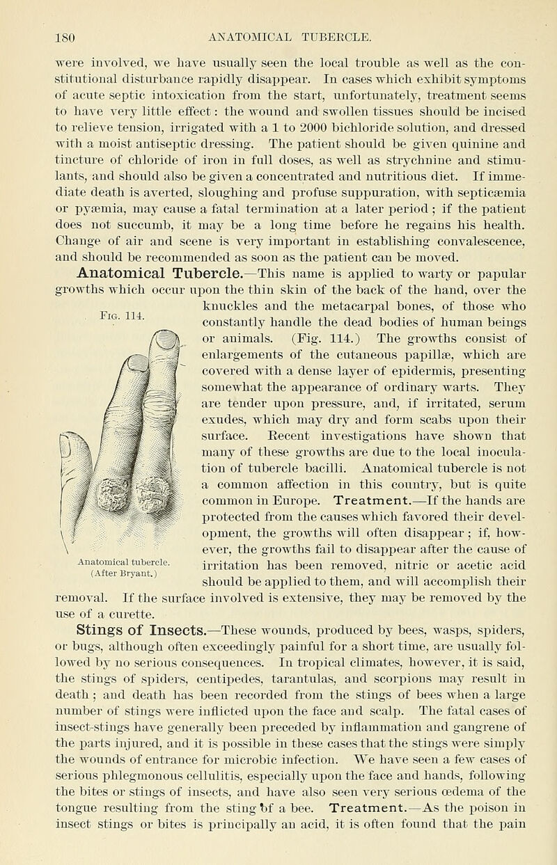 Fig. 114. were involved, we have usually seen the local trouble as well as the con- stitutional disturbance rapidly disappear. In cases which exhibit symptoms of acute septic intoxication from the start, unfortunately, treatment seems to have very little effect: the wound and swollen tissues should be incised to relieve tension, irrigated with a 1 to 2000 bichloride solution, and dressed with a moist antiseptic dressing. The patient should be given quinine and tincture of chloride of iron in full doses, as well as strychnine and stimu- lants, and should also be given a concentrated and nutritious diet. If imme- diate death is averted, sloiighing and profuse suppuration, with septicaemia or pyaemia, may cause a fatal termination at a later period ; if the patient does not succumb, it may be a long time before he regains his health. Change of air and scene is very important in establishing convalescence, and should be recommended as soon as the j)atient can be moved. Anatomical Tubercle.—This name is applied to warty or papular growths which occur upon the thin skin of the back of the hand, over the knvickles and the metacarpal bones, of those who constantly handle the dead bodies of human beings or animals. (Fig. 114.) The growths consist of enlargements of the cutaneous papillae, which are covered with a dense layer of epidermis, presenting somewhat the appearance of ordinary warts. They are tender upon pressure, and, if irritated, serum exudes, which may dry and form scabs upon their surface. Eecent investigations have shown that many of these growths are due to the local inocula- tion of tubercle bacilli. Anatomical tubercle is not a common affection in this country, but is quite common in Europe. Treatment.—If the hands are protected from the causes which favored their devel- opment, the growths will often disappear; if, how- ever, the growths fail to disappear after the cause of irritation has been removed, nitric or acetic acid should be aj)i)lied to them, and will accomj)lish their removal. If the surface involved is extensive, they may be removed by the use of a curette. Stings of Insects.—These wounds, produced by bees, wasps, spiders, or bugs, although often exceedingly i^ainful for a short time, are usually fol- lowed by no serioiis consequences. In tropical climates, however, it is said, the stings of spiders, centipedes, tarantulas, and scori^ions may result in death; and death has been i-ecorded from the stings of bees when a large number of stings were inflicted upon the face and scalp. The fatal cases of insect-stings have generally been preceded by inflammation and gangrene of the parts injured, and it is possible in these cases that the stings were simply the wounds of entrance for microbic infection. We have seen a few cases of serious phlegmonous cellulitis, especially upon the face and hands, following the bites or stings of insects, and have also seen very serious oedema of the tongue resulting from the sting l>f a bee. Treatment.—As the poison in insect stings or bites is principally an acid, it is often found that the pain rr Anatomiciil tubercle. (After Bryant.)