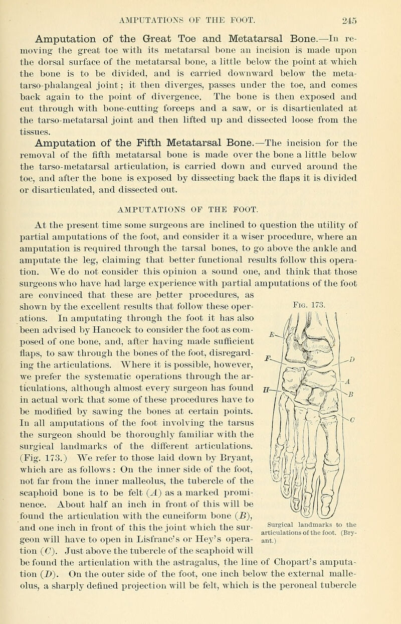 Fig. 173. Amputation of the Great Toe and Metatarsal Bone.—In re- moving the great toe with its metatarsal bone an incision is made upon the dorsal surface of the metatarsal bone, a little below the point at which the bone is to be divided, and is carried downward below the meta- tarso-phalangeal joint; it then diverges, passes under the toe, and comes back again to the jjoint of divergence. The bone is then exposed and cut through with bone-cutting forceps and a saw, or is disarticulated at the tarso-metatarsal joint and then lifted up and dissected loose from the tissues. Amputation of the Fifth Metatarsal Bone.—The incision for the removal of the fifth metatarsal bone is made over the bone a little below the tarso-metatarsal articulation, is carried down and curved around the toe, and after the bone is exposed by dissecting back the flaps it is divided or disarticulated, and dissected out. AMPUTATIONS OP THE FOOT. At the present time some surgeons are inclined to question the utility of partial amputations of the foot, and consider it a wiser procedure, where an amputatioa is required through the tarsal bones, to go above the ankle and amputate the leg, claiming that better functional results follow this opera- tion. We do not consider this opinion a sound one, and think that those surgeons who have had large experience with partial amputations of the foot are convinced that these are better procedures, as shown by the excellent results that follow these oper- ations. In amputating through the foot it has also been advised by Hancock to consider the foot as com- posed of one bone, and, after having made sufficient flaps, to saw through the bones of the foot, disregard- ing the articulations. Where it is possible, however, we prefer the systematic oiierations through the ar- ticulations, although almost every surgeon has found in actual work that some of these procedures have to be modified by sawing the bones at certain points. In all amputations of the foot involving the tarsus the surgeon should be thoroughly familiar with the surgical landmarks of the different articulations. (Pig. 173.) We refer to those laid down by Bryant, which are as follows : On the inner side of the foot, not far from the inner malleolus, the tubercle of the scaphoid bone is to be felt (A) as a marked promi- nence. About half an inch in front of this will be found the articulation with the cuneiform bone (B), and one inch in front of this the joint which the sur- geon will have to open in Lisfranc's or Hey's opera- tion (0). Just above the tubercle of the scaphoid will be found the articulation with the astragalus, the line of Chopart's amputa- tion (i>). On the outer side of the foot, one inch below the external malle- olus, a sharply defined projection will be felt, which is the peroneal tubercle Surgical landmarks to the articulations of the foot. (Brj'- ant.)