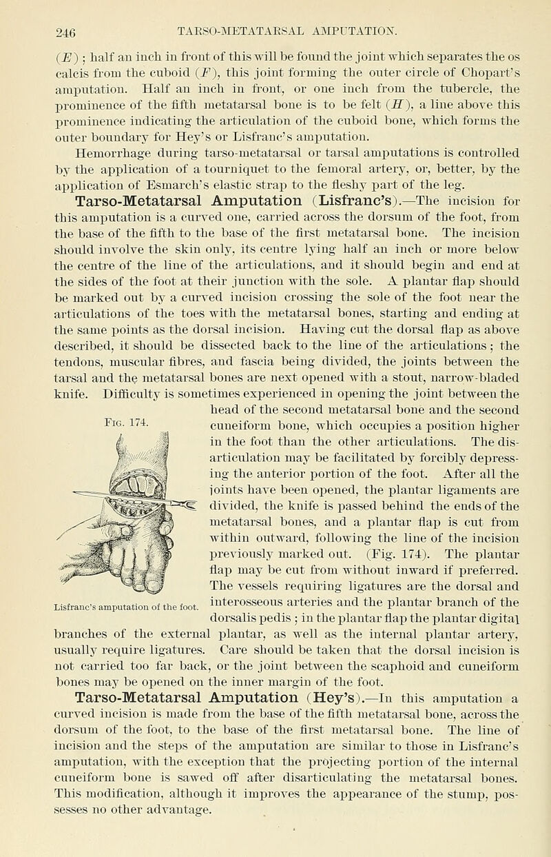(JE) ; half au inch in fi-ont of this will be foiiud the joint which separates the os calcis from the cuboid (F), this joint forming the outer circle of Choi^art's amputation. Half an inch in front, or one inch from the tubei'cle, the l^rominence of the iifth metatarsal bone is to be felt (S), a line above this prominence indicating the articulation of the cuboid bone, which forms the outer boundary for Hey's or Lisfranc's amj)utation. Hemorrhage during tarsometatarsal or tarsal am^^utations is controlled by the application of a tourniquet to the femoral artery, or, better, by the application of Esmarch's elastic strap to the fleshy jjart of the leg. Tarso-Metatarsal Amputation (Lisfranc's).—The incision for this amputation is a curved one, carried across the dorsum of the foot, from the base of the fifth to the base of the first metatarsal bone. The incision should involve the skin only, its centre lying half an inch or more below the centre of the line of the articulations, and it should begin and end at the sides of the foot at their junction with the sole. A plantar flap should be marked out by a curved incision crossing the sole of the foot near the articulations of the toes with the metatarsal bones, starting and ending at the same points as the dorsal incision. Having cut the dorsal flap as above described, it should be dissected back to the line of the articulations; the tendons, muscular fibres, and fascia being divided, the joints between the tarsal and the metatarsal bones are next opened with a stout, narrow-bladed knife. Difdculty is sometimes experienced in opening the joint between the head of the second metatarsal bone and the second ^^° ^^^ «. cuneiform bone, which occupies a position higher in the foot than the other articulations. The dis- articulation may be facilitated by forcibly depress- ing the anterior i^ortion of the foot. After all the ioints have been opened, the plantar ligaments are divided, the knife is passed behind the ends of the metatarsal bones, and a plantar flap is cut from within outward, following the line of the incision previously marked out. (Fig. 174). The plantar fla]3 may be cut from without inward if preferred. MOfea^ The vessels requiring ligatures are the dorsal and Lisfranc's amputation of the foot, intcrosseous artcrics and the plantar branch of the dorsalis pedis ; in the j)lantar flaj) the plantar digital branches of the external plantar, as well as the internal plantar arterj-, usually require ligatures. Care should be taken that the dorsal incision is not carried too far back, or the joint between the scaphoid and cuneiform bones may be opened on the inner margin of the foot. Tarso-Metatarsal Amputation (Hey's).—In this amputation a curved incision is made from the base of the fifth metatarsal bone, across the dorsum of the foot, to the base of the first metatarsal bone. The line of incision and the steps of the amputation are similar to those in Lisfranc's amputation, with the exception that the projecting portion of the internal cuneiform bone is sawed off after disarticulating the metatarsal bones. This modification, although it imxJroves the appearance of the stump, pos- .sesses no other advantage.