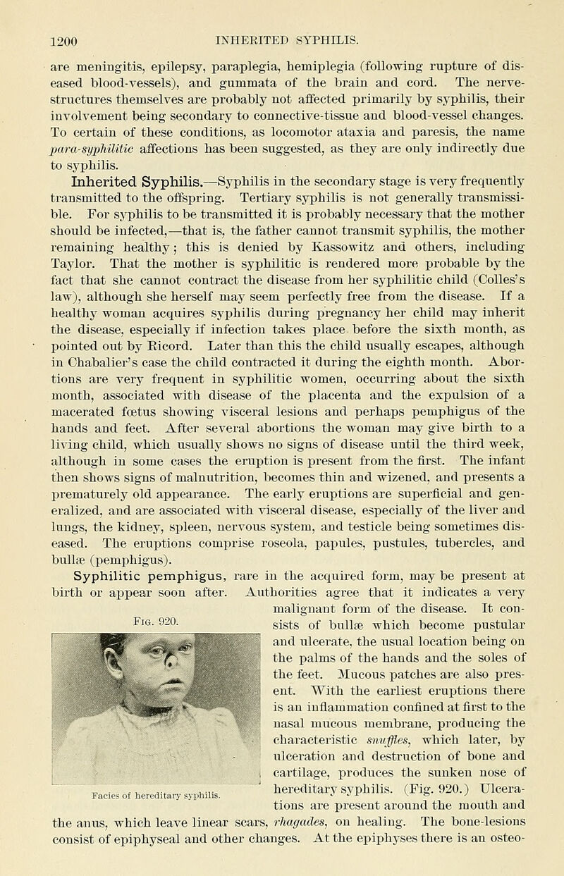 are meningitis, epilepsy, paraplegia, hemiplegia (following rupture of dis- eased blood-vessels), and gummata of the brain and cord. The nerve- structures themselves are probably not affected primarily by syphilis, their involvement being secondary to connective-tissue and blood-vessel changes. To certain of these conditions, as locomotor ataxia and paresis, the name para-syphilitic affections has been suggested, as they are only indirectly due to syphilis. Inherited Syphilis.—Syphilis in the secondary stage is very frequently transmitted to the offspring. Tertiary syphilis is not generally transmissi- ble. For syphilis to be transmitted it is probably necessary that the mother should be infected,—that is, the father cannot transmit syphilis, the mother remaining healthy; this is denied by Kassowitz and others, including Taylor. That the mother is syphilitic is rendered more probable by the fact that she cannot contract the disease from her syphilitic child (Colics's law), although she herself may seem perfectly free from the disease. If a healthy woman acquires syj)hilis during pregnancy her child may inherit the disease, especially if infection takes place before the sixth month, as pointed out by Eicord. Later than this the child usually escapes, although in Chabalier's case the child contracted it during the eighth month. Abor- tions are very frequent in syphilitic women, occurring about the sixth month, associated with disease of the placenta and the expulsion of a macerated foetus showing visceral lesions and perhaps pemphigus of the hands and feet. After several abortions the woman may give birth to a living child, which usually shows no signs of disease until the third week, although in some cases the eruption is present from the first. The infant then shows signs of malnutrition, becomes thin and wizened, and presents a prematurely old appearance. The early eruptions are superficial and gen- eralized, and are associated with visceral disease, especially of the liver and lungs, the kidney, spleen, nervous system, and testicle being sometimes dis- eased. The eruptions comprise roseola, papules, pustules, tubercles, and bullae (pemjjhigus). Syphilitic pemphigus, rare in the acquired form, may be present at birth or appear soon after. Authorities agree that it indicates a very malignant form of the disease. It con- ^^'^ ^-'^ sists of bullfe which become pustular and ulcerate, the usual location being on the palms of the hands and the soles of the feet. Mucous patches are also pres- ent. With the earliest eruptions there is an inflammation confined at first to the nasal mucous membrane, producing the characteristic snuffles, which later, by ulceration and destruction of bone and cartilage, produces the sunken nose of hereditary syphilis. (Fig. 920.) Ulcera- tions are present around the mouth and the anus, which leave linear scars, rluigades, on healing. The bone-lesions consist of epiphyseal and other changes. At the epiphyses there is an osteo- Facies of hereditai-j' syphilis.