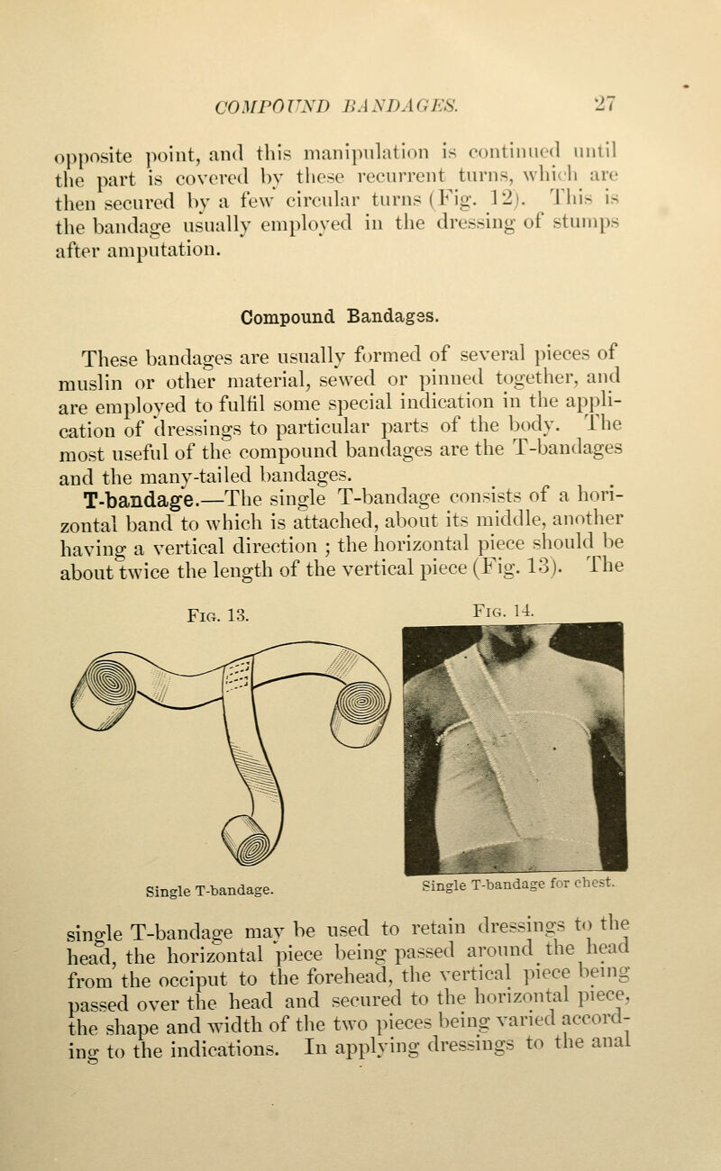 opposite point, and this manipulation is continued until the part is covered by these recurrent turns, which are then secured by a few circular turns (Fig. 12). This is the bandage usually employed in the dressing of stump- after amputation. Compound Bandages. These bandages are usually formed of several pieces of muslin or other material, sewed or pinned together, and are employed to fulfil some special indication in the appli- cation of dressings to particular parts of the body. The most useful of the compound bandages are the T-bandages and the many-tailed bandages. T-bandage.—The single T-bandage consists of a hori- zontal band to which is attached, about its middle, another having a vertical direction ; the horizontal piece should be about twice the length of the vertical piece (Fig. 13). The Fig. 13 Fig. 14. Single T-bandage. Single T-bandage for chest. single T-banda^e may be used to retain dressings to the head, the horizontal piece being passed around the head from the occiput to the forehead, the vertical piece being passed over the head and secured to the horizontal piece, the shape and width of the two pieces being varied accord- ing to the indications. In applying dressings to the anal