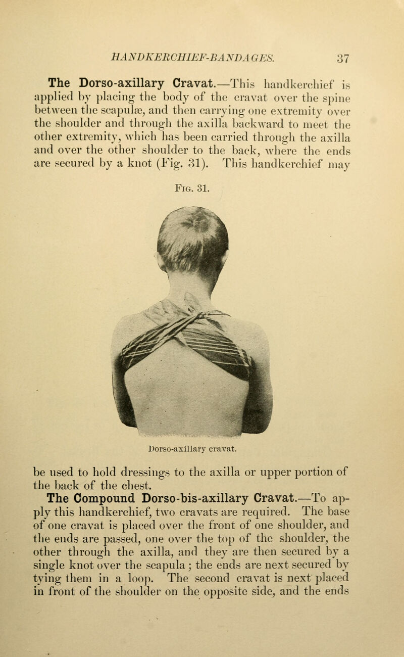 The Dorso-axillary Cravat.—This handkerchief is applied by placing the body of the cravat over the spine between the scapulas, and then carrying one extremity over the shoulder and through the axilla backward to meet the other extremity, which has been carried through the axilla and over the other shoulder to the back, where the ends are secured by a knot (Fig. 31). This handkerchief may Fig. 31. Dorso-axillarv cravat. be used to hold dressings to the axilla or upper portion of the back of the chest. The Compound Dorso-bis-axillary Cravat.—To ap- ply this handkerchief, two cravats are required. The base of one cravat is placed over the front of one shoulder, and the ends are passed, one over the top of the shoulder, the other through the axilla, and they are then secured by a single knot over the scapula ; the ends are next secured by tying them in a loop. The second cravat is next placed in front of the shoulder on the opposite side, and the ends