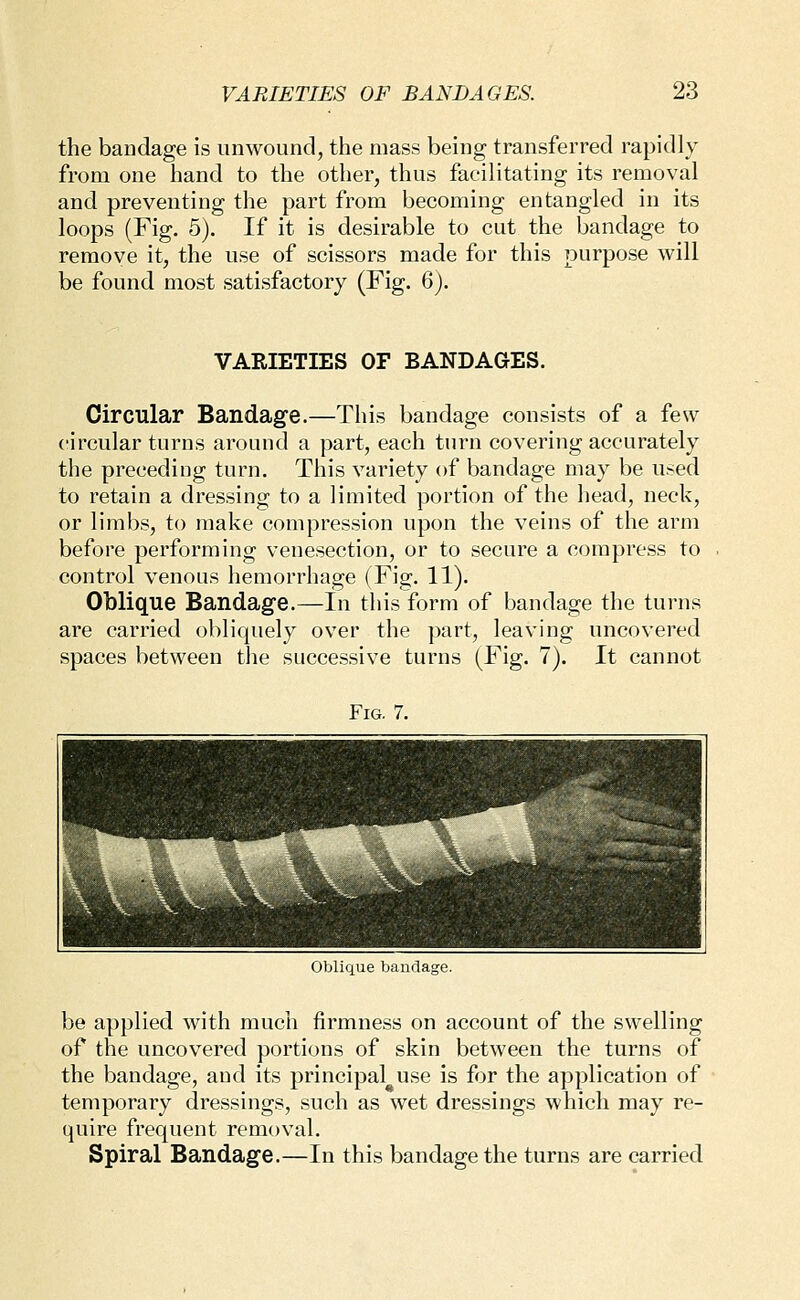 the bandage is unwound, the mass being transferred rapidly from one hand to the other, thus facilitating its removal and preventing the part from becoming entangled in its loops (Fig. 5). If it is desirable to cut the bandage to remove it, the use of scissors made for this purpose will be found most satisfactory (Fig. 6). VARIETIES OF BANDAGES. Circular Bandage.—This bandage consists of a few circular turns around a part, each turn covering accurately the preceding turn. This variety of bandage may be used to retain a dressing to a limited portion of the head, neck, or limbs, to make compression upon the veins of the arm before performing venesection, or to secure a compress to control venous hemorrhage (Fig. 11). Oblique Bandage.—In this form of bandage the turns are carried obliquely over the part, leaving uncovered spaces between the successive turns (Fig. 7). It cannot Fig. 7. Oblique bandage. be applied with much firmness on account of the swelling of the uncovered portions of skin between the turns of the bandage, and its principal use is for the application of temporary dressings, such as wet dressings which may re- quire frequent removal. Spiral Bandage.—In this bandage the turns are carried