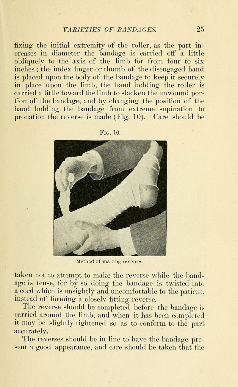 fixing the initial extremity of the roller, as the part in- creases in diameter the bandage is carried oflf a little obliquely to the axis of the limb for from four to six inches; the index finger or thumb of the disengaged hand is placed upon the body of the bandage to keep it securely in place upon the limb, the hand holding the roller is carried a little toward the limb to slacken the unwound por- tion of the bandage, and by changing the position of the hand holding the bandage from extreme supination to pronation the reverse is made (Fig. 10). Care should be Fig. 10. Method of making reverses. taken not to attempt to make the reverse while the band- age is tense, for by so doing the bandage is twisted into a cord which is unsightly and uncomfortable to the patient, instead of forming a closely fitting reverse. The reverse should be completed before the bandage is carried around the limb, and when it has been completed it may be slightly tightened so as to conform to the part accurately. The reverses should be in line to have the bandage pre- sent a good appearance, and care should be taken that the