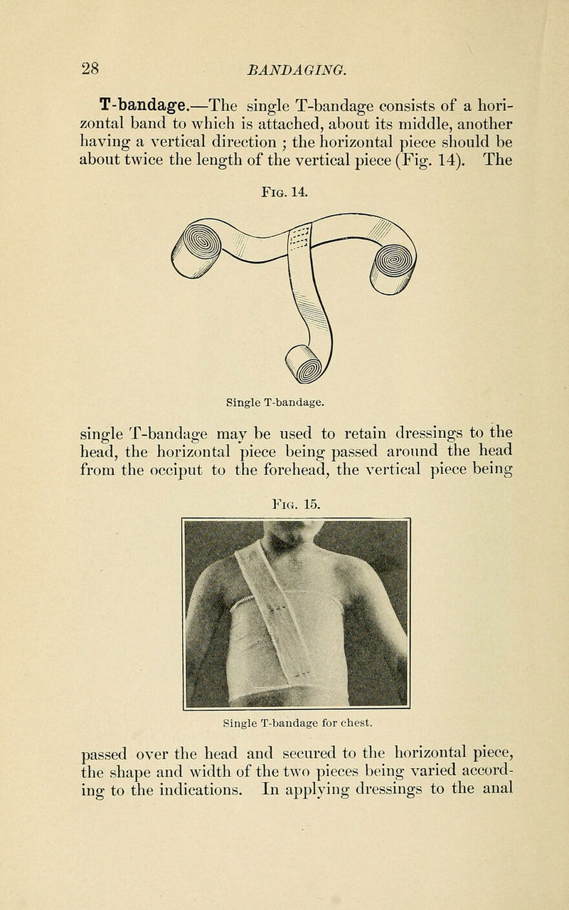 T-bandage.—The single T-bandage consists of a hori- zontal band to which is attached, about its middle, another having a vertical direction ; the horizontal piece should be about twice the length of the vertical piece (Fig. 14). The Fig. 14. Single T-bandage. single T-bandage may be used to retain dressings to the head, the horizontal piece being passed around the head from the occiput to the forehead, the vertical piece being Fig. 15. Single T-bandage for chest. passed over the head and secured to the horizontal piece, the shape and width of the two pieces being varied accord- ing to the indications. In applying dressings to the anal