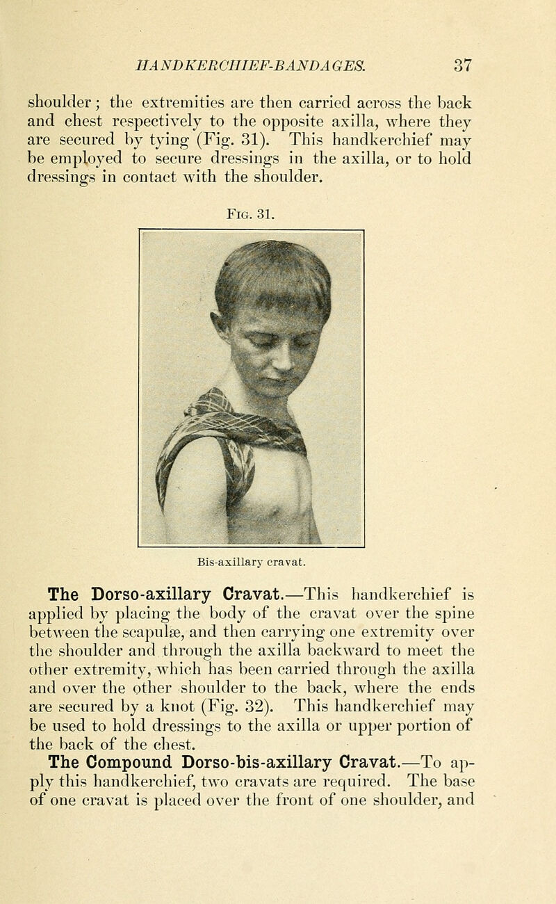 shoulder; the extremities are then carried across the back and chest respectively to the opposite axilla, where they are secured by tying (Fig. 31). This handkerchief may be employed to secure dressings in the axilla, or to hold dressings in contact with the shoulder. Fig. 31. Bis-axillary cravat. The Dorso-axillary Cravat.—This handkerchief is applied by placing the body of the cravat over the spine between the scapulae, and then carrying one extremity over the shoulder and through the axilla backward to meet the other extremity, which has been carried through the axilla and over the other shoulder to the back, where the ends are .«ecured by a knot (Fig. 32). This handkerchief may be used to hold dressings to the axilla or upper portion of the back of the che.st. The Compound Dorso-bis-axillary Cravat.—To ap- ply this handkerchief, two cravats are required. The base of one cravat is placed over the front of one shoulder, and