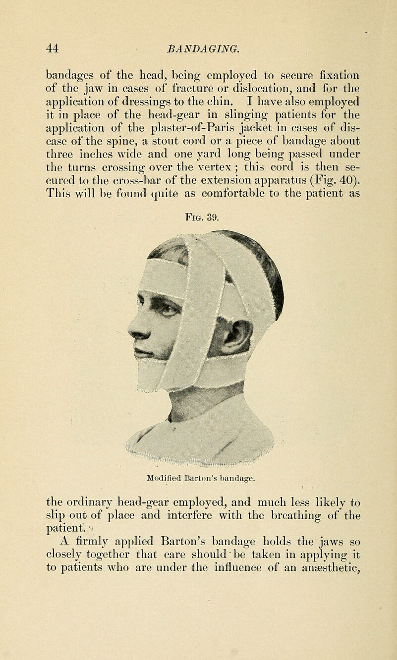 bandages of the head, being employed to secure fixation of the jaw in cases of fracture or dislocation, and for the application of dressings to the chin. I have also employed it in place of the head-gear in slinging patients for the application of the plaster-of-Paris jacket in cases of dis- ease of the spine, a stout cord or a piece of bandage about three inches wide and one yard long being passed under the turns crossing over the vertex; this cord is then se- cured to the cross-bar of the extension apparatus (Fig. 40). This will be found quite as comfortable to the patient as Fig. 39. y Modified Barton's bandage. the ordinary head-gear employed, and much less likely to slip out of place and interfere with the breathing of the patient. ■ A firmly applied Barton's bandage holds the jaws so closely together that care should be taken in applying it to patients who are under the influence of an ansesthetic,