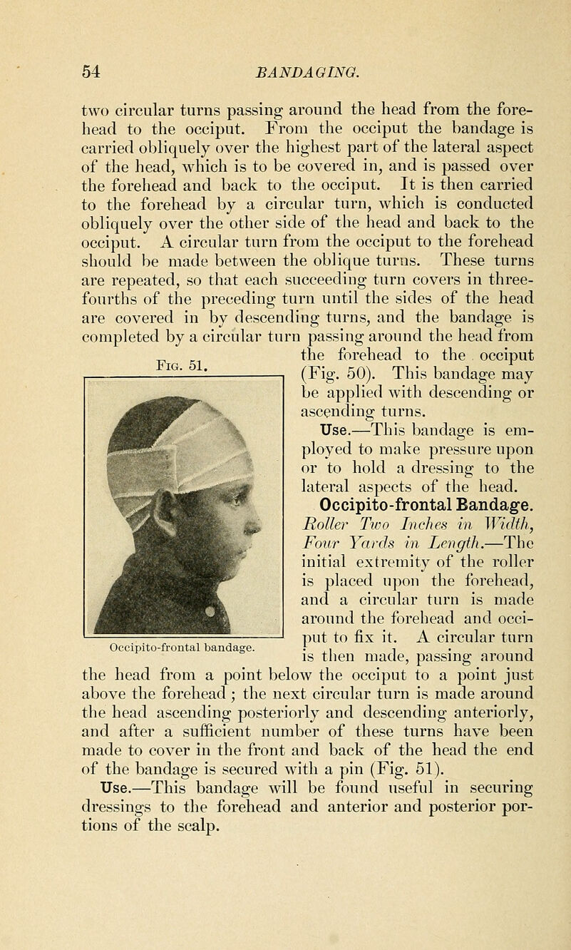 two circular turns passing around the head from the fore- head to the occiput. From the occiput the bandage is carried obliquely over the highest part of the lateral aspect of the head, which is to be covered in, and is passed over the forehead and back to the occiput. It is then carried to the forehead by a circular turn, which is conducted obliquely over the other side of the head and back to the occiput. A circular turn from the occiput to the forehead should be made between the oblique turns. These turns are repeated, so that each succeediug turn covers in three- fourths of the preceding turn until the sides of the head are covered in by descending turns, and the bandage is completed by a circular turn passing around the head from the forehead to the occiput (Fig. 50). This bandage may be applied with descending or ascending turns. Use.—This bandage is em- ployed to make pressure upon or to hold a dressing to the lateral aspects of the head. Occipito-frontal Bandage. Roller Two Inches in Width, Four Yards in Length.—The initial extremity of the roller is placed upon the forehead, and a circular turn is made around the forehead and occi- put to fix it. A circular turn is then made, passing around the head from a point below the occiput to a point just above the forehead; the next circular turn is made around the head ascending posteriorly and descending anteriorly, and after a sufficient number of these turns have been made to cover in the front and back of the head the end of the bandage is secured with a pin (Fig. 51). Use.—This bandage will be found useful in securing dressings to the forehead and anterior and posterior por- tions of the scalp. Occipito-frontal bandage.