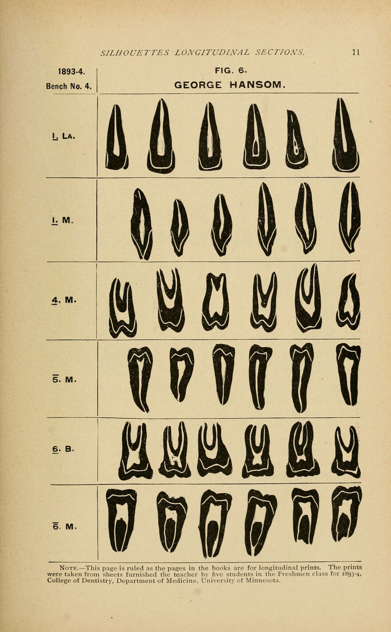 1893-4. Bench No. 4. SILHOUETTES LONGITUDINAL SECTIONS. FIG. 6. GEORGE HANSOM. 11 L La. \ m 4ftU r. M. 4. M. WUU 5. M. nn\ 6. B. 6. M. vv^S'Sff Note.—This page is ruled as the pages in the books are for longitudinal prints. The prints were taken from sheets furnished the teacher by five students in the Freshmen class for 1893-4, College of Dentistry, Department of Medicine, University of Minnesota.