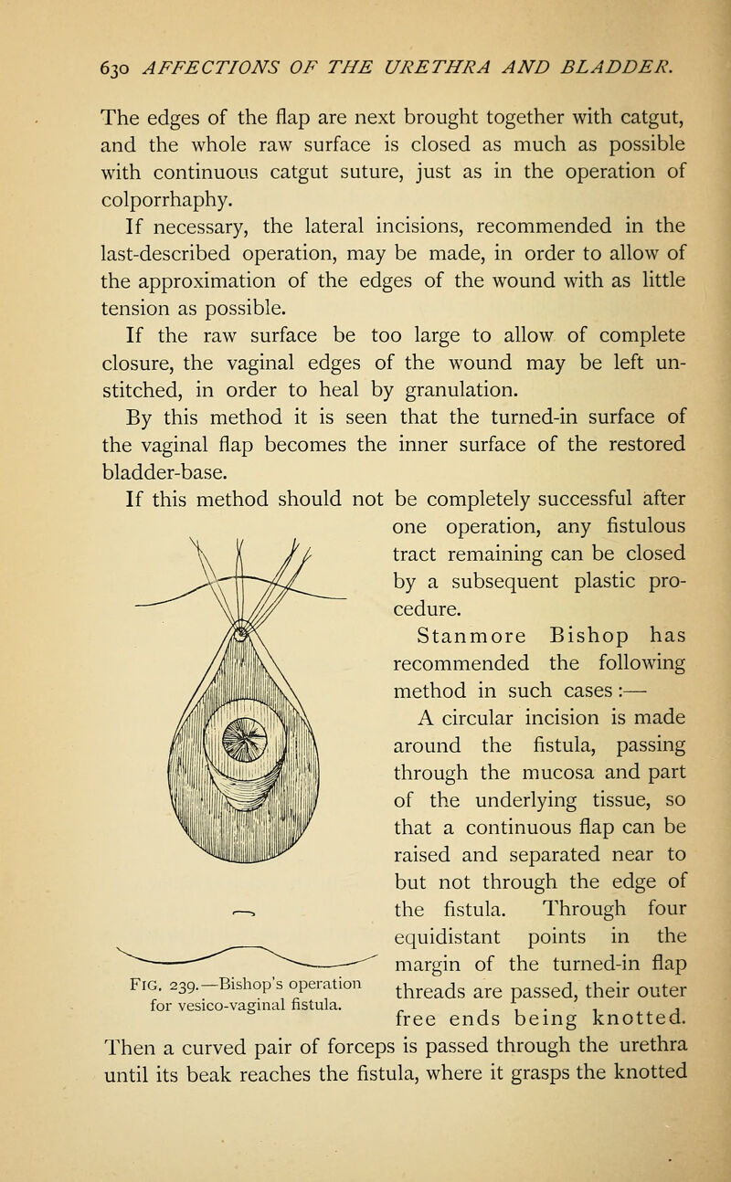 The edges of the flap are next brought together with catgut, and the whole raw surface is closed as much as possible with continuous catgut suture, just as in the operation of colporrhaphy. If necessary, the lateral incisions, recommended in the last-described operation, may be made, in order to allow of the approximation of the edges of the wound with as little tension as possible. If the raw surface be too large to allow of complete closure, the vaginal edges of the wound may be left un- stitched, in order to heal by granulation. By this method it is seen that the turned-in surface of the vaginal flap becomes the inner surface of the restored bladder-base. If this method should not be completely successful after one operation, any fistulous tract remaining can be closed by a subsequent plastic pro- cedure. Stanmore Bishop has recommended the following method in such cases:— A circular incision is made around the fistula, passing through the mucosa and part of the underlying tissue, so that a continuous flap can be raised and separated near to but not through the edge of the fistula. Through four equidistant points in the margin of the turned-in flap threads are passed, their outer free ends being knotted. Then a curved pair of forceps is passed through the urethra until its beak reaches the fistula, where it grasps the knotted Fig. 239.—Bishop's operation for vesico-vaginal fistula.