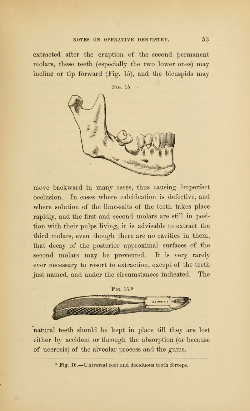 extracted after the eruption of the second permanent molars, these teeth (especially the two lower ones) may incline or tip forward (Fig. 15), and the bicuspids may Fig. 15. move backward in many cases, thus causing imperfect occlusion. In cases where calcification is defective, and where solution of the lime-salts of the teeth takes place rapidly, and the first and second molars are still in posi- tion with their pulps living, it is advisable to extract the third molars, even though there are no ca\dties in them, that decay of the posterior approximal surfaces of the second molars may be prevented. It is very rarely ever necessary to resort to extraction, except of the teeth just named, and under the circumstances indicated. The Fig. 16.* natural teeth should be kept in place till they are lost either by accident or through the absorption (or because of necrosis) of the alveolar process and the gums. * Fig. 16.—Universal root and deciduous tooth forceps.