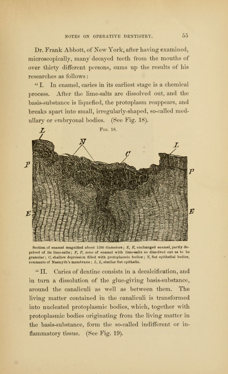 Dr. Frank Abbott, of New York, after having examined, microscopically, many decayed teeth from the mouths of over thirty different persons, sums up the results of his researches as follows:  I. In enamel, caries in its earliest stage is a chemical process. After the lime-salts are dissolved out, and the basis-substance is liquefied, the protoplasm reappears, and breaks apart into small, irregularly-shaped, so-called med- ullary or embryonal bodies. (See Fig. 18). J^ Fio. 18. Section of enamel magnified about 1200 diameters ; E, E, unchanged enamel, partly de- prived of its lime-salts; P, P, zone of enamel with lime-salts so dissolved out as to be granular; C, shallow depression filled with protoplasmic bodies ; iV, flat epithelial bodies, remnants of Nasmyth's njembrane ; L, L, similar, flat epithelia.  II. Caries of dentine consists in a decalcification, and in turn a dissolution of the glue-giving basis-substance, around the canaliculi as well as between them. The living matter contained in the canaliculi is transformed into nucleated protoplasmic bodies, which, together with protoplasmic bodies originating from the living matter in the basis-substance, form the so-called indifferent or in- flammatory tissue. (See Fig. 19).