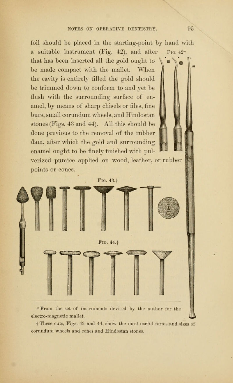 foil should be placed in the starting-point by hand with a suitable instrument (Fig. 42), and after Fig. 42* that has been inserted all the gold ought to be made compact with the mallet. When the cavity is entirely filled the gold should be trimmed down to conform to and yet be flush with the surrounding surface of en- amel, by means of sharp chisels or files, fine burs, small corundum wheels, and Hindostan stones (Figs. 43 and 44). All this should be done previous to the removal of the rubber dam, after which the gold and surrounding enamel ought to be finely finished with pul- verized pumice applied on wood, leather, or rubber points or cones. Fig. 43.t * From the set of instruments devised by the author for the electro-magnetic mallet. f These cuts, Figs. 43 and 44, show the most useful forms and sizes of corundum wheels and cones and Hindostan stones.