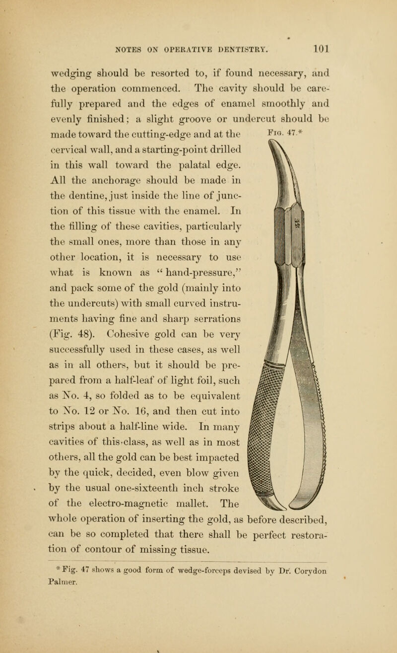 wedging should be resorted to, if found necessary, and the operation commenced. The cavity sliould be care- fully prepared and the edges of enamel smoothly and evenly finished; a slight groove or undercut should be made toward the cutting-edge and at the ^lo- 47.* cervical wall, and a starting-point drilled in this wall toward the palatal edge. All the anchorage should be made in the dentine, just inside the line of junc- tion of this tissue with the enamel. In the filling of these cavities, particularly the small ones, more than those in any other location, it is necessary to use what is known as  hand-pressure, and pack some of the gold (mainly into the undercuts) with small curved instru- ments having fine and sharp serrations (Fig. 48). Cohesive gold can be very successfully used in these cases, as well as in all others, but it should be pre- pared from a half-leaf of light foil, such as Xo. 4, so folded as to be equivalent to Xo. 12 or Xo. 16, and then cut into strips about a half-line wide. In many cavities of this-class, as well as in most others, all the gold can be best impacted by the quick, decided, even blow given by the usual one-sixteenth inch stroke of the electro-magnetic mallet. The whole operation of inserting the gold, as before described, can be so completed that there shall be perfect restora- tion of contour of missing tissue. ^S9 * Fig. 47 shows a good form of wedge-forceps devised by Dr. Corydon Palmer.