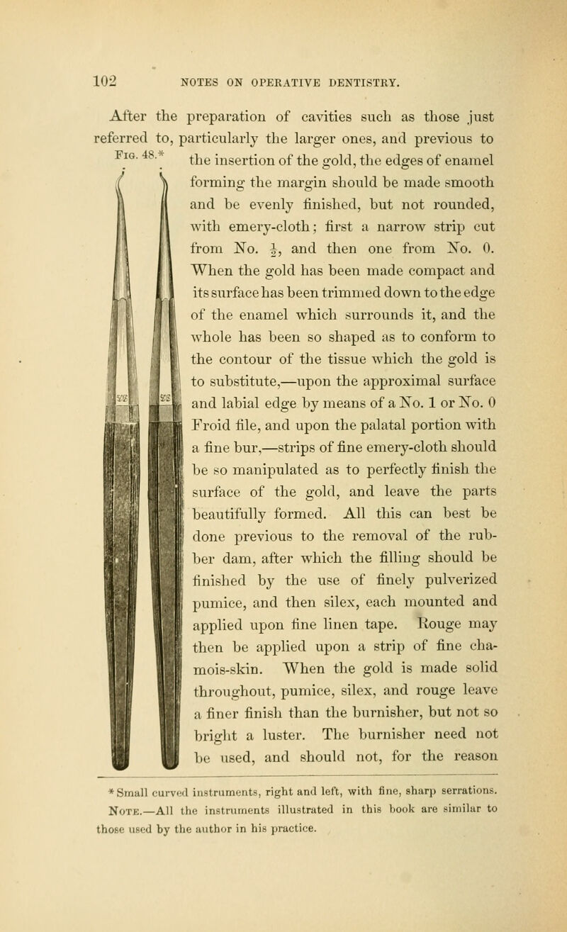 Fig. 48.* 1 After the preparation of cavities such as those just referred to, particularly the larger ones, and previous to the insertion of the gold, the edges of enamel forming the margin should be made smooth and be evenly finished, but not rounded, with emery-cloth; first a narrow strip cut from No. J, and then one from ^o. 0. When the gold has been made compact and its siirface has been trimmed down to the edge of the enamel which surrounds it, and the whole has been so shaped as to conform to the contour of the tissue which the gold is to substitute,—upon the approximal surface and labial edge by means of a No. 1 or No. 0 Froid file, and upon the palatal portion with a fine bur,—strips of fine emery-cloth should be so manipulated as to perfectly finish the surface of the gold, and leave the parts beautifully formed. All this can best be done previous to the removal of the rub- l)er dam, after which the filling should be finished by the use of finely pulverized pumice, and then silex, each mounted and applied upon fine linen tape. Rouge may then be applied upon a strip of fine cha- mois-skin. When the gold is made solid throughout, pumice, silex, and rouge leave a finer finish than the burnisher, but not so brio-ht a luster. The burnisher need not be used, and should not, for the reason * Small curved in.strumcnt.s, right and left, with fine, sharp serrations. NoTK.—All the instruments illustrated in this book are similar to those used by the author in his practice.