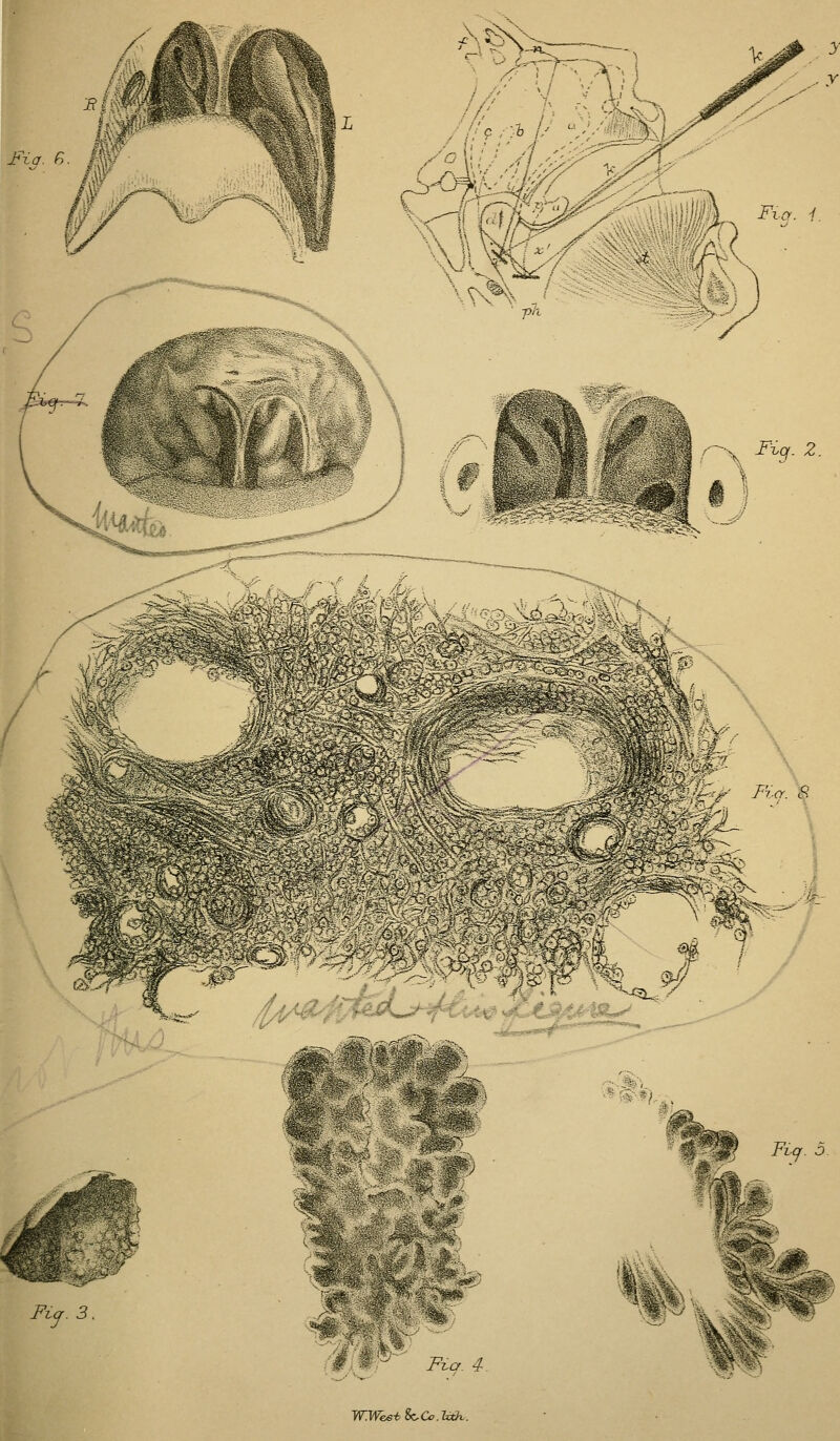 Fia. f> WWes-eSc^Cclxtk.