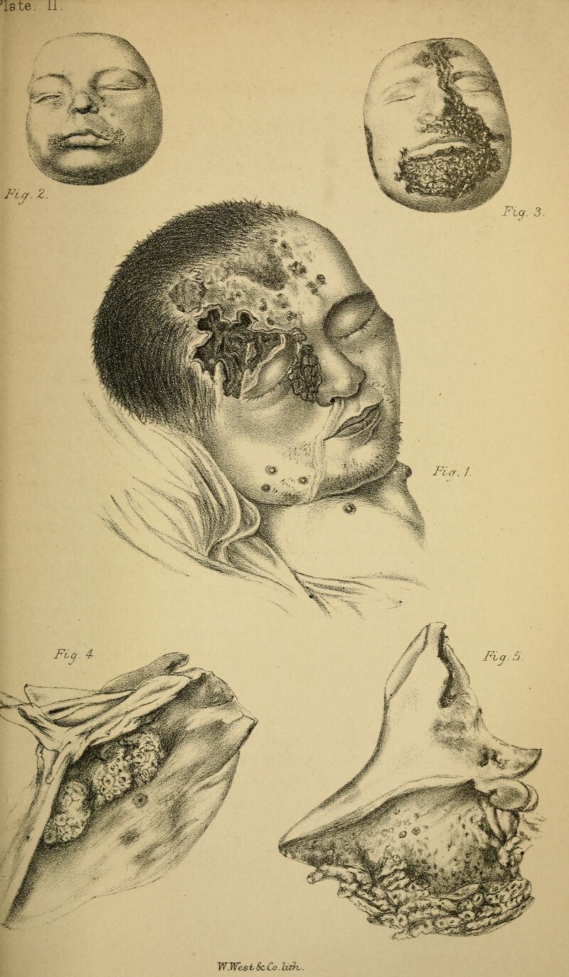 iste. il Fvqr. Z WWeshScCo.h;^.