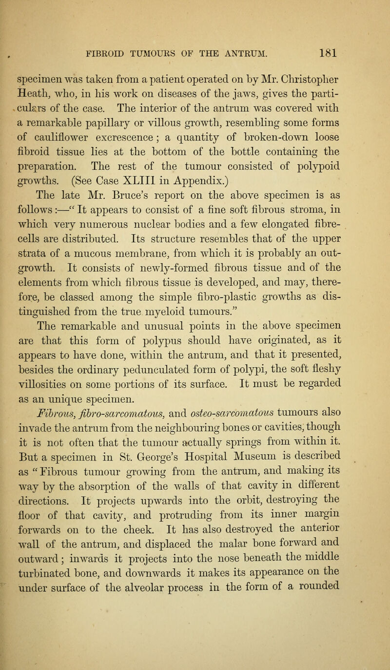 specimen was taken from a patient operated on by Mr. Christoplier Heath, who, in his work on diseases of the jaws, gives the parti- culars of the case. The interior of the antrum was covered with a remarkable papillary or villous growth, resembling some forms of cauliflower excrescence; a quantity of broken-down loose fibroid tissue lies at the bottom of the bottle containing the preparation. The rest of the tumour consisted of polypoid growths. (See Case XLIII in Appendix.) The late Mr. Bruce's report on the aboA^e specimen is as follows :—'' It appears to consist of a fine soft fibrous stroma, in which very numerous nuclear bodies and a few elongated fibre- cells are distributed. Its structure resembles that of the upper strata of a mucous membrane, from which it is probably an out- growth. It consists of newly-formed fibrous tissue and of the elements from which fibrous tissue is developed, and may, there- fore, be classed among the simple fibro-plastic growths as dis- tinguished from the true myeloid tumours. The remarkable and unusual points in the above specimen are that this form of polypus should have originated, as it appears to have done, within the antrum, and that it presented, besides the ordinary pedunculated form of polypi, the soft fleshy viUosities on some portions of its sm^face. It must be regarded as an unique specimen. Fibrous, fibro-sarcomatoiis, and osteo-sarcomatous tumours also invade the antrum from the neighbouring bones or cavities, though it is not often that the tumour actually springs from within it. But a specimen in St. George's Hospital Museum is described as Fibrous tumour growing from the antrum, and making its way by the absorption of the waUs of that cavity in different directions. It projects upwards into the orbit, destroying the floor of that cavity, and protruding from its inner margin forwards on to the cheek. It has also destroyed the anterior waU of the antrum, and displaced the malar bone forward and outward; inwards it projects into the nose beneath the middle turbinated bone, and downwards it makes its appearance on the under surface of the alveolar process in the form of a rounded