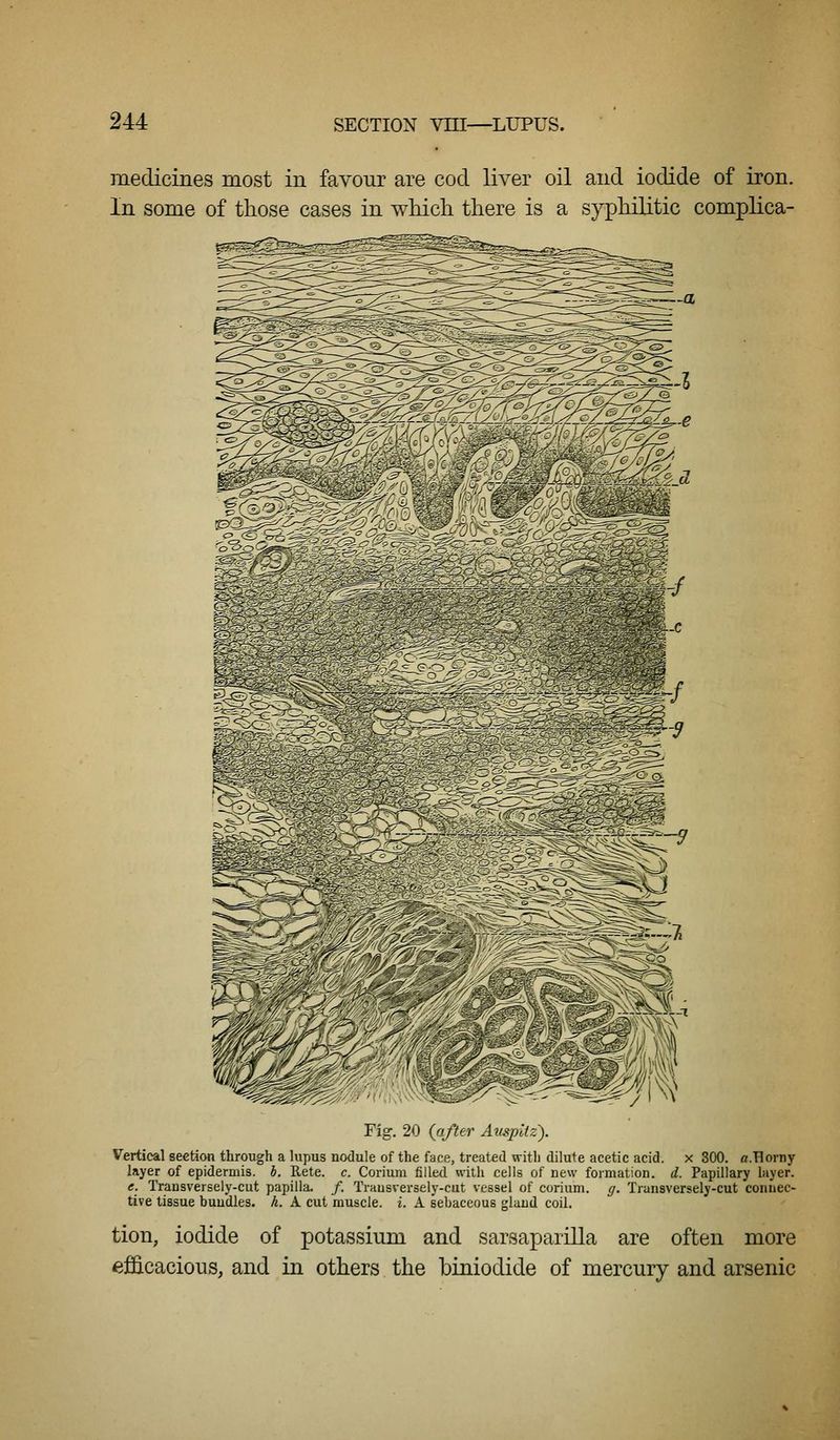 medicines most in favour are cod liver oil and iodide of iron. In some of those cases in which there is a syphilitic complica- Fig. 20 {after Ampilz). Vertical section through a lupus nodule of the face, treated witli dilute acetic acid, x 300. a.Horny kyer of epidermis, h. Rete. c. Corium filled with cells of new formation, d. Papillary layer. e. Trausversely-cut papilla. /. Trnusversely-cut vessel of corium. g. Transversely-cut connec- tive tissue buudles. h. A cut muscle, i. A sebaceous gland coil, tion, iodide of potassium and sarsaparilla are often more efficacious, and in others the biniodide of mercury and arsenic