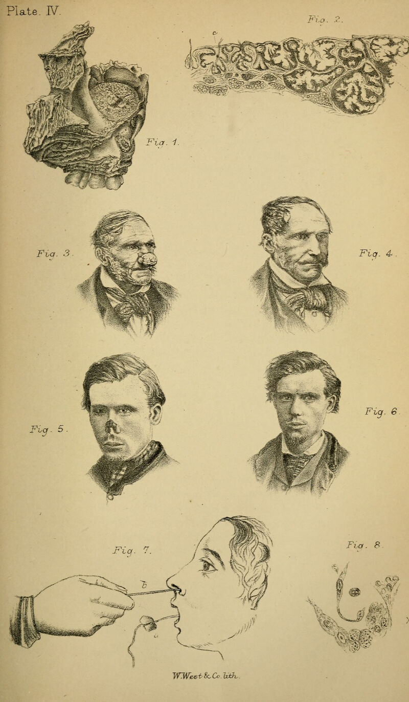 Plate. N. r i.o. '-'ta. i. Fhq. 4. Fi.a. 5. Fvg. 6 Fi.a. 8 -w^ WWeei>S<:.a.'Uth..