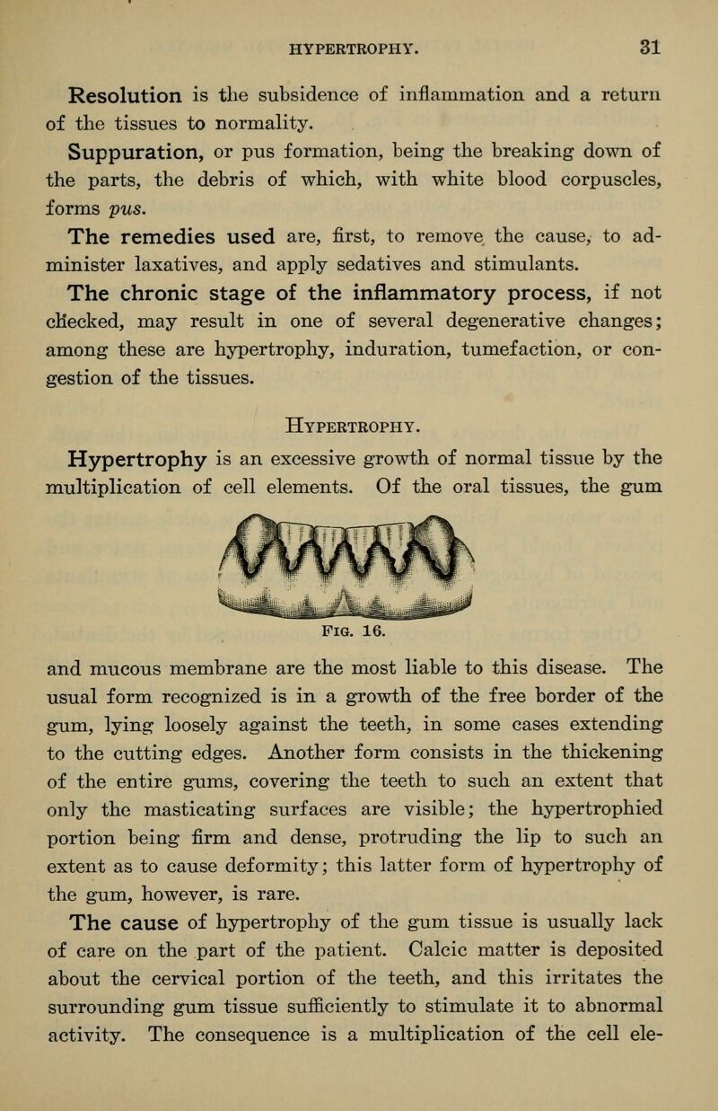 Resolution is the subsidence of inflammation and a return of the tissues to normality. Suppuration, or pus formation, being the breaking down of the parts, the debris of which, with white blood corpuscles, forms pus. The remedies used are, first, to remove the cause, to ad- minister laxatives, and apply sedatives and stimulants. The chronic stage of the inflammatory process, if not checked, may result in one of several degenerative changes; among these are hypertrophy, induration, tumefaction, or con- gestion of the tissues. Hypertrophy. Hypertrophy is an excessive growth of normal tissue by the multiplication of cell elements. Of the oral tissues, the gum Fig. 16. and mucous membrane are the most liable to this disease. The usual form recognized is in a growth of the free border of the gum, lying loosely against the teeth, in some cases extending to the cutting edges. Another form consists in the thickening of the entire gums, covering the teeth to such an extent that only the masticating surfaces are visible; the hypertrophied portion being firm and dense, protruding the lip to such an extent as to cause deformity; this latter form of hypertrophy of the gum, however, is rare. The cause of hypertrophy of the gum tissue is usually lack of care on the part of the patient. Calcic matter is deposited about the cervical portion of the teeth, and this irritates the surrounding gum tissue sufficiently to stimulate it to abnormal activity. The consequence is a multiplication of the cell ele-