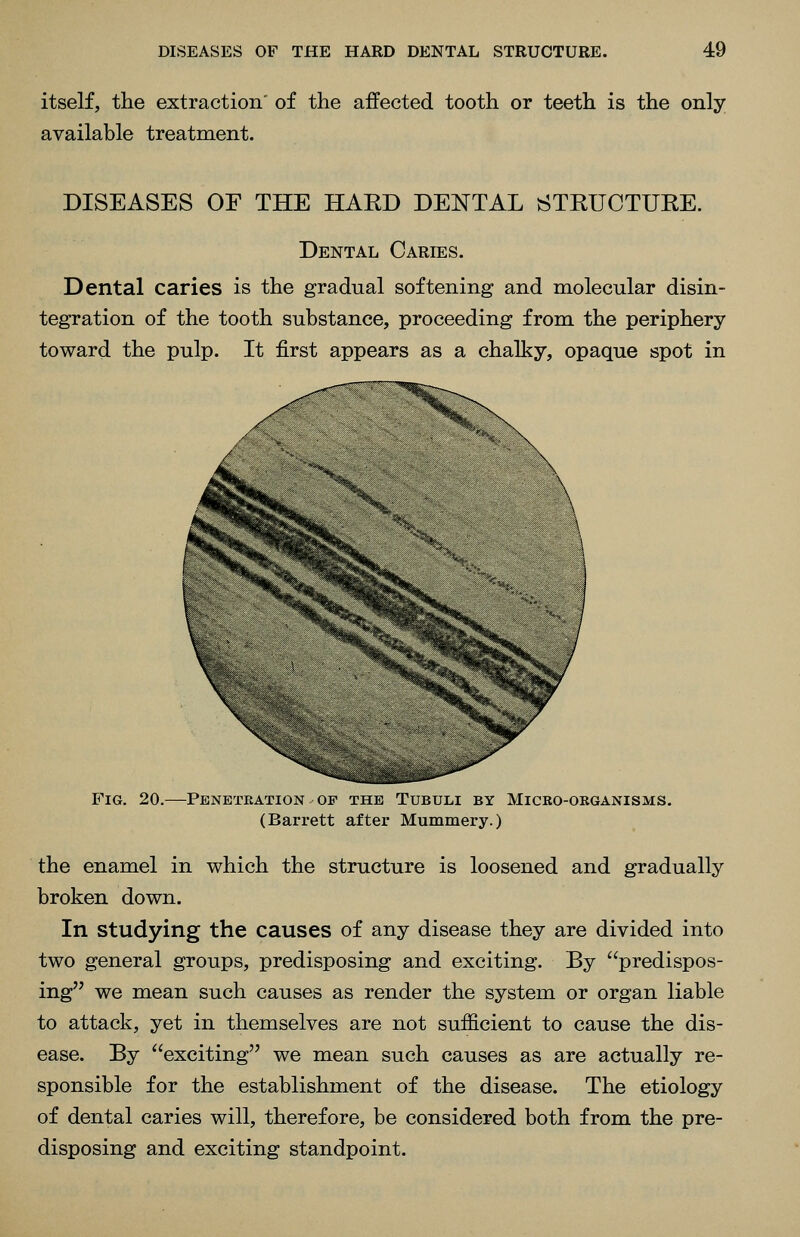 itself, the extraction' of the affected tooth or teeth is the only available treatment. DISEASES OF THE HAED DENTAL STRUCTURE. Dental Caries. Dental caries is the gradual softening and molecular disin- tegration of the tooth substance, proceeding from the periphery toward the pulp. It first appears as a chalky, opaque spot in Fig. 20.- -PENETEATION OF THE TUBULI BY MiCRO-OKGANISMS. (Barrett after Mummery.) the enamel in which the structure is loosened and gradually broken down. In studying the causes of any disease they are divided into two general groups, predisposing and exciting. By predispos- ing we mean such causes as render the system or organ liable to attack, yet in themselves are not sufficient to cause the dis- ease. By exciting we mean such causes as are actually re- sponsible for the establishment of the disease. The etiology of dental caries will, therefore, be considered both from the pre- disposing and exciting standpoint.