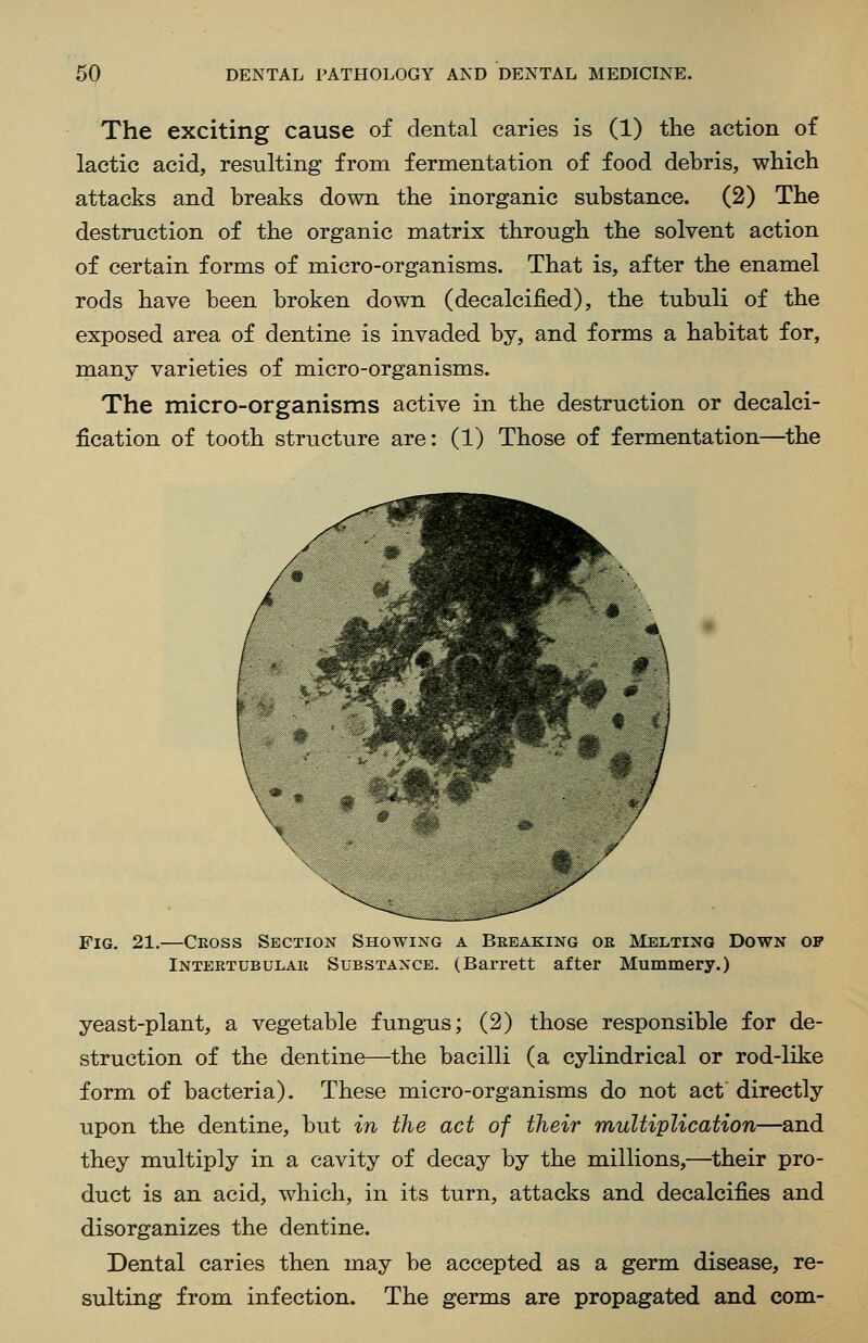 The exciting cause of dental caries is (1) the action of lactic acid, resulting from fermentation of food debris, which attacks and breaks down the inorganic substance. (2) The destruction of the organic matrix through the solvent action of certain forms of micro-organisms. That is, after the enamel rods have been broken down (decalcified), the tubuli of the exposed area of dentine is invaded by, and forms a habitat for, many varieties of micro-organisms. The micro-organisms active in the destruction or decalci- fication of tooth structure are: (1) Those of fermentation—^the Fig. 21.—Ceoss Section Showing a Beeaking ok Melting Down of Intektubulae Substance. (Bax-rett after Mummery.) yeast-plant, a vegetable fungus; (2) those responsible for de- struction of the dentine—the bacilli (a cylindrical or rod-like form of bacteria). These micro-organisms do not act directly upon the dentine, but in the act of their multiplication—and they multiply in a cavity of decay by the millions,—^their pro- duct is an acid, which, in its turn, attacks and decalcifies and disorganizes the dentine. Dental caries then may be accepted as a germ disease, re- sulting from infection. The germs are propagated and com-