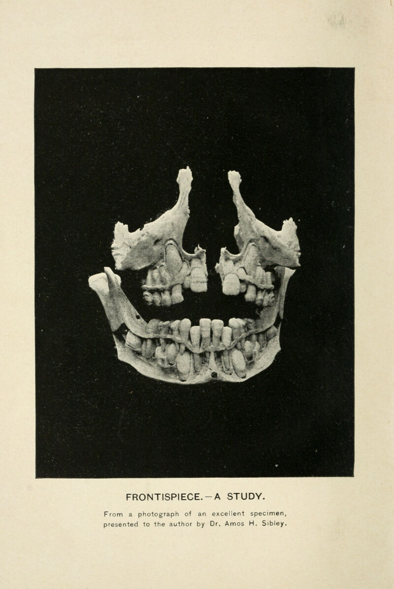 FRONTISPIECE.-A STUDY. From a photograph of an excellent specimen, presented to the author by Dr. Amos H. Sibley.