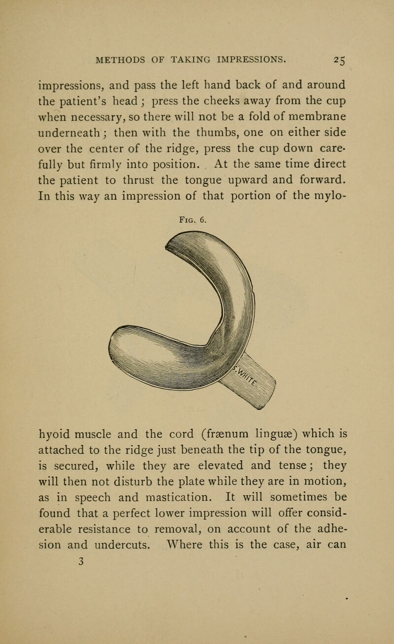 impressions, and pass the left hand back of and around the patient's head; press the cheeks away from the cup when necessary, so there will not be a fold of membrane underneath; then with the thumbs, one on either side over the center of the ridge, press the cup down care- fully but firmly into position. At the same time direct the patient to thrust the tongue upward and forward. In this way an impression of that portion of the mylo- Fig. 6. hyoid muscle and the cord (fraenum linguae) which is attached to the ridge just beneath the tip of the tongue, is secured, while they are elevated and tense; they will then not disturb the plate while they are in motion, as in speech and mastication. It will sometimes be found that a perfect lower impression will offer consid- erable resistance to removal, on account of the adhe- sion and undercuts. Where this is the case, air can