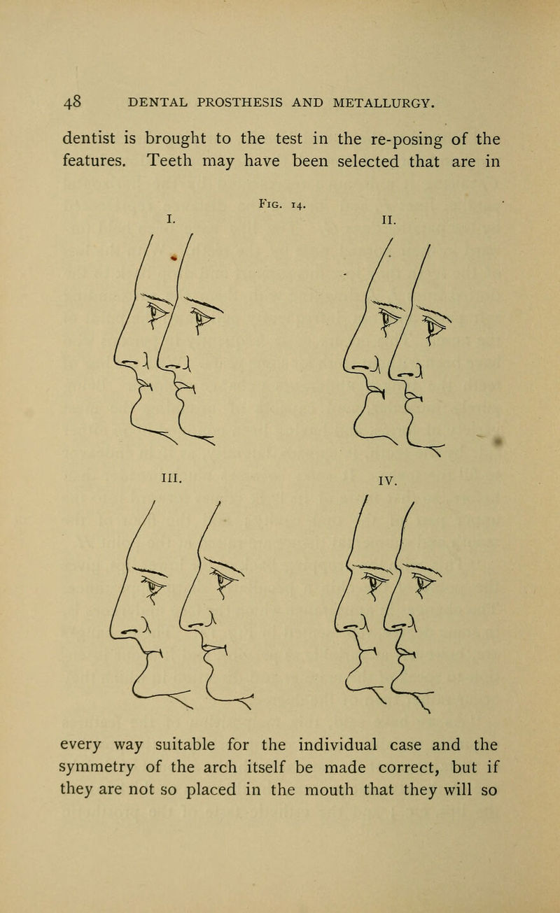 dentist is brought to the test in the re-posing of the features. Teeth may have been selected that are in Fig. 14. II. III. IV. every way suitable for the individual case and the symmetry of the arch itself be made correct, but if they are not so placed in the mouth that they will so