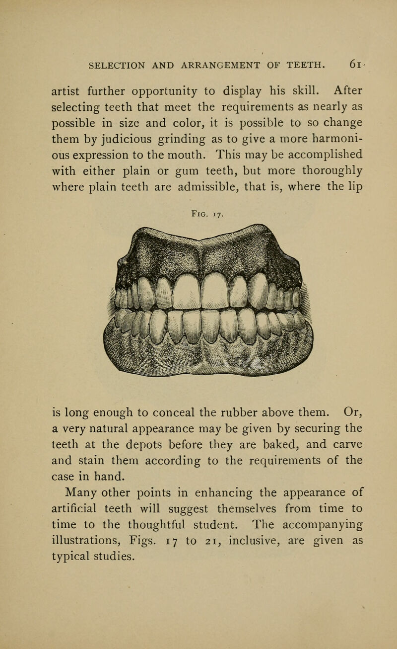 artist further opportunity to display his skill. After selecting teeth that meet the requirements as nearly as possible in size and color, it is possible to so change them by judicious grinding as to give a more harmoni- ous expression to the mouth. This may be accomplished with either plain or gum teeth, but more thoroughly where plain teeth are admissible, that is, where the lip Fig. 17. is long enough to conceal the rubber above them. Or, a very natural appearance may be given by securing the teeth at the depots before they are baked, and carve and stain them according to the requirements of the case in hand. Many other points in enhancing the appearance of artificial teeth will suggest themselves from time to time to the thoughtful student. The accompanying illustrations, Figs. 17 to 21, inclusive, are given as typical studies.