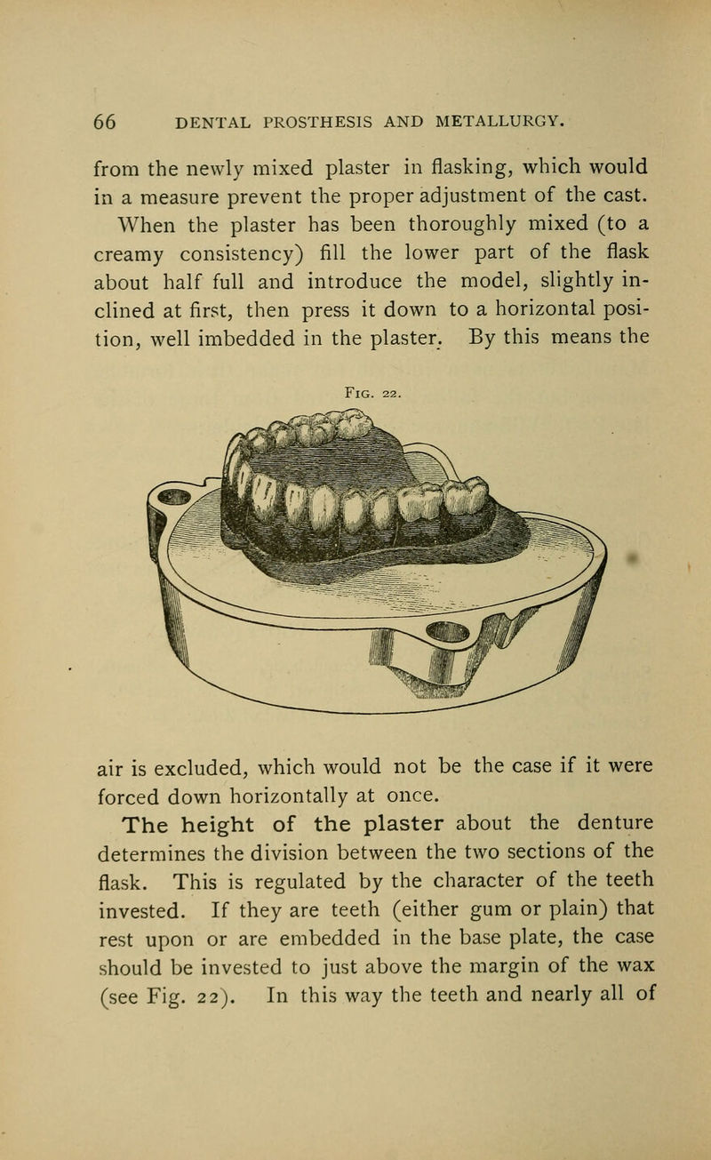 from the newly mixed plaster in flasking, which would in a measure prevent the proper adjustment of the cast. When the plaster has been thoroughly mixed (to a creamy consistency) fill the lower part of the flask about half full and introduce the model, slightly in- clined at first, then press it down to a horizontal posi- tion, well imbedded in the plaster. By this means the Fig. 22. air is excluded, which would not be the case if it were forced down horizontally at once. The height of the plaster about the denture determines the division between the two sections of the flask. This is regulated by the character of the teeth invested. If they are teeth (either gum or plain) that rest upon or are embedded in the base plate, the case should be invested to just above the margin of the wax (see Fig. 22). In this way the teeth and nearly all of