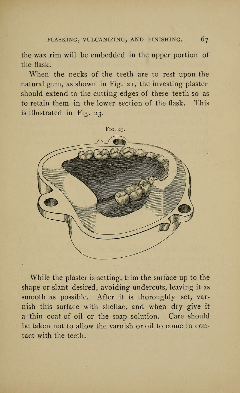 the wax rim will be embedded in the upper portion of the flask. When the necks of the teeth are to rest upon the natural gum, as shown in Fig. 21, the investing plaster should extend to the cutting edges of these teeth so as to retain them in the lower section of the flask. This is illustrated in Fig. 23. Fig. 23. While the plaster is setting, trim the surface up to the shape or slant desired, avoiding undercuts, leaving it as smooth as possible. After it is thoroughly set, var- nish this surface with shellac, and when dry give it a thin coat of oil or the soap solution. Care should be taken not to allow the varnish or oil to come in con- tact with the teeth.