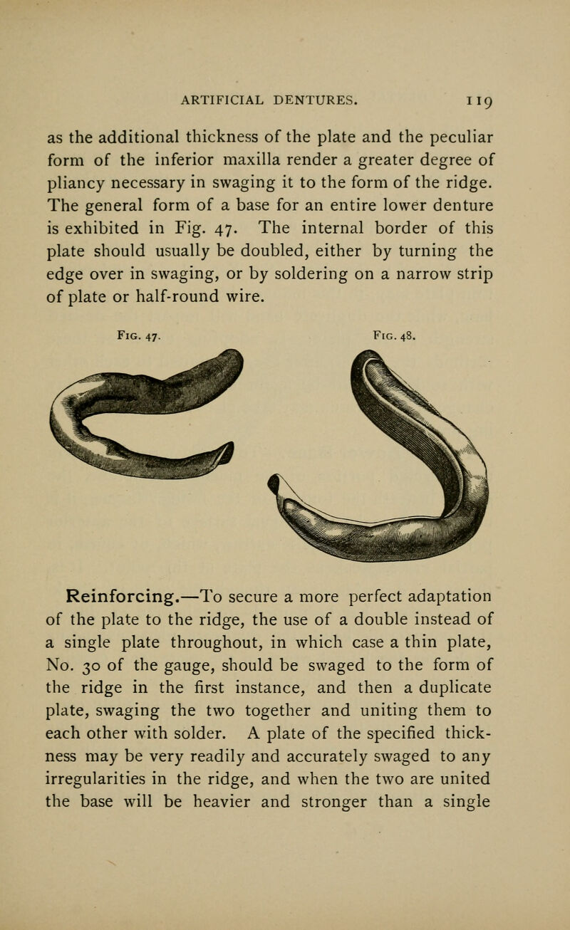 as the additional thickness of the plate and the peculiar form of the inferior maxilla render a greater degree of pliancy necessary in swaging it to the form of the ridge. The general form of a base for an entire lower denture is exhibited in Fig. 47. The internal border of this plate should usually be doubled, either by turning the edge over in swaging, or by soldering on a narrow strip of plate or half-round wire. Fig. 47. Fig.48. Reinforcing.—To secure a more perfect adaptation of the plate to the ridge, the use of a double instead of a single plate throughout, in which case a thin plate, No. 30 of the gauge, should be swaged to the form of the ridge in the first instance, and then a duplicate plate, swaging the two together and uniting them to each other with solder. A plate of the specified thick- ness may be very readily and accurately swaged to any irregularities in the ridge, and when the two are united the base will be heavier and stronger than a single