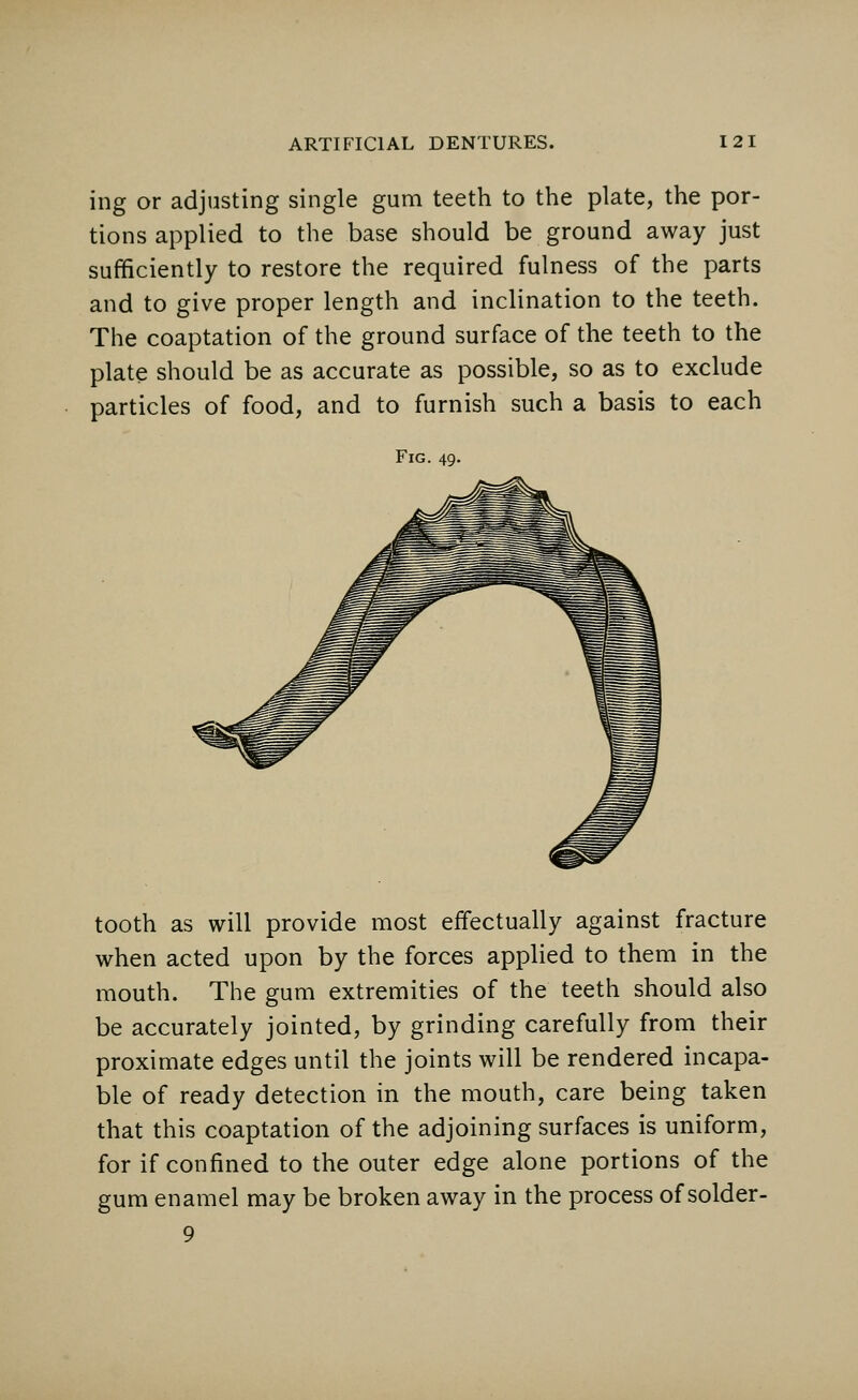 ing or adjusting single gum teeth to the plate, the por- tions applied to the base should be ground away just sufficiently to restore the required fulness of the parts and to give proper length and inclination to the teeth. The coaptation of the ground surface of the teeth to the plate should be as accurate as possible, so as to exclude particles of food, and to furnish such a basis to each Fig. 49. tooth as will provide most effectually against fracture when acted upon by the forces applied to them in the mouth. The gum extremities of the teeth should also be accurately jointed, by grinding carefully from their proximate edges until the joints will be rendered incapa- ble of ready detection in the mouth, care being taken that this coaptation of the adjoining surfaces is uniform, for if confined to the outer edge alone portions of the gum enamel may be broken away in the process of solder- 9