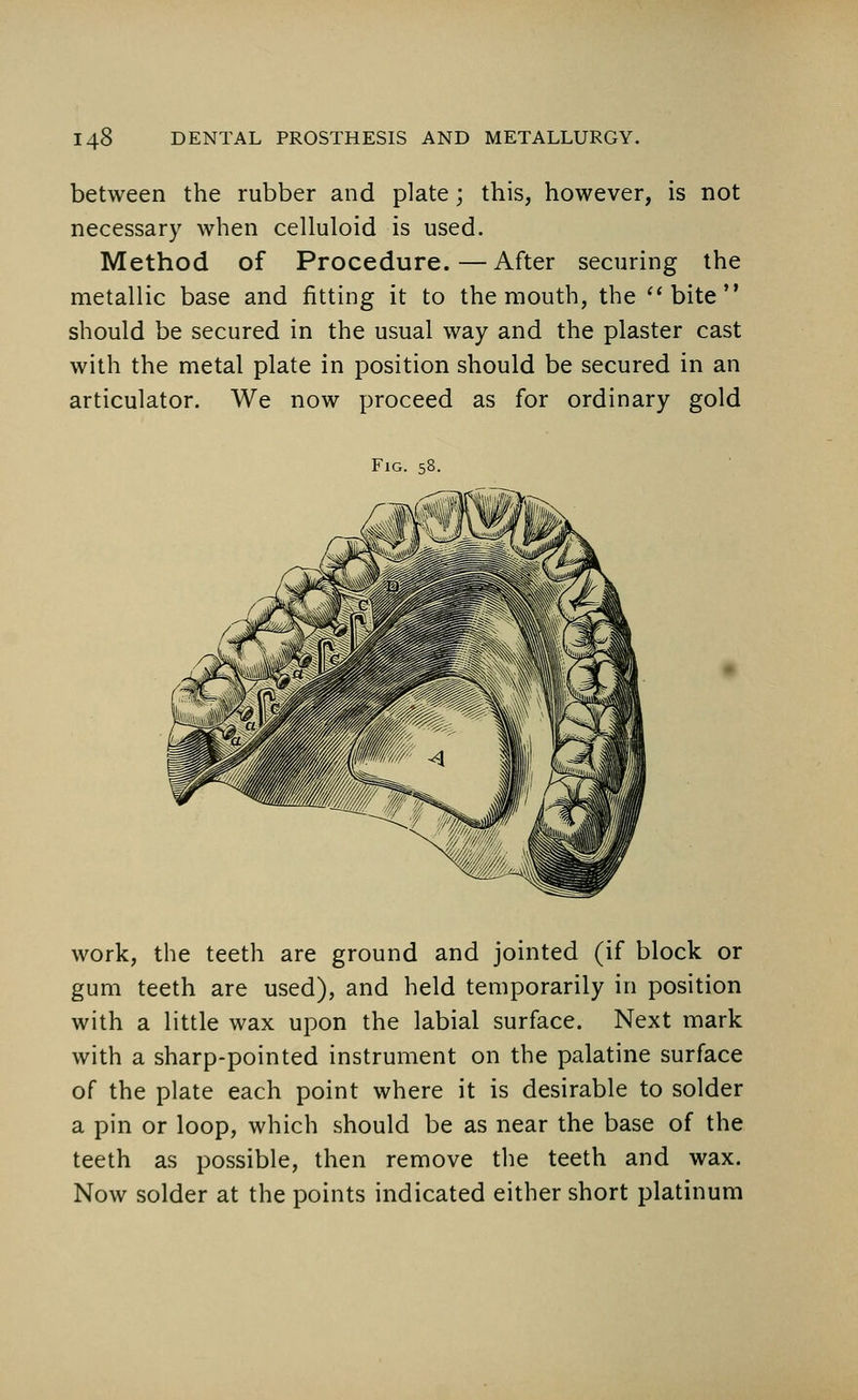 between the rubber and plate; this, however, is not necessary when celluloid is used. Method of Procedure.—After securing the metallic base and fitting it to the mouth, the bite should be secured in the usual way and the plaster cast with the metal plate in position should be secured in an articulator. We now proceed as for ordinary gold Fig. 58. work, the teeth are ground and jointed (if block or gum teeth are used), and held temporarily in position with a little wax upon the labial surface. Next mark with a sharp-pointed instrument on the palatine surface of the plate each point where it is desirable to solder a pin or loop, which should be as near the base of the teeth as possible, then remove the teeth and wax. Now solder at the points indicated either short platinum