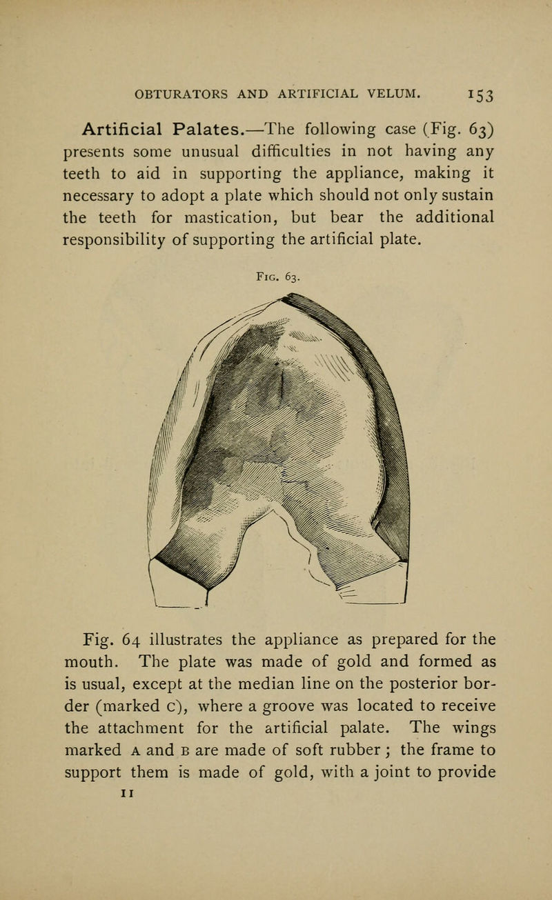 Artificial Palates.—The following case (Fig. 63) presents some unusual difficulties in not having any teeth to aid in supporting the appliance, making it necessary to adopt a plate which should not only sustain the teeth for mastication, but bear the additional responsibility of supporting the artificial plate. Fig. 63. Fig. 64 illustrates the appliance as prepared for the mouth. The plate was made of gold and formed as is usual, except at the median line on the posterior bor- der (marked c), where a groove was located to receive the attachment for the artificial palate. The wings marked a and b are made of soft rubber; the frame to support them is made of gold, with a joint to provide