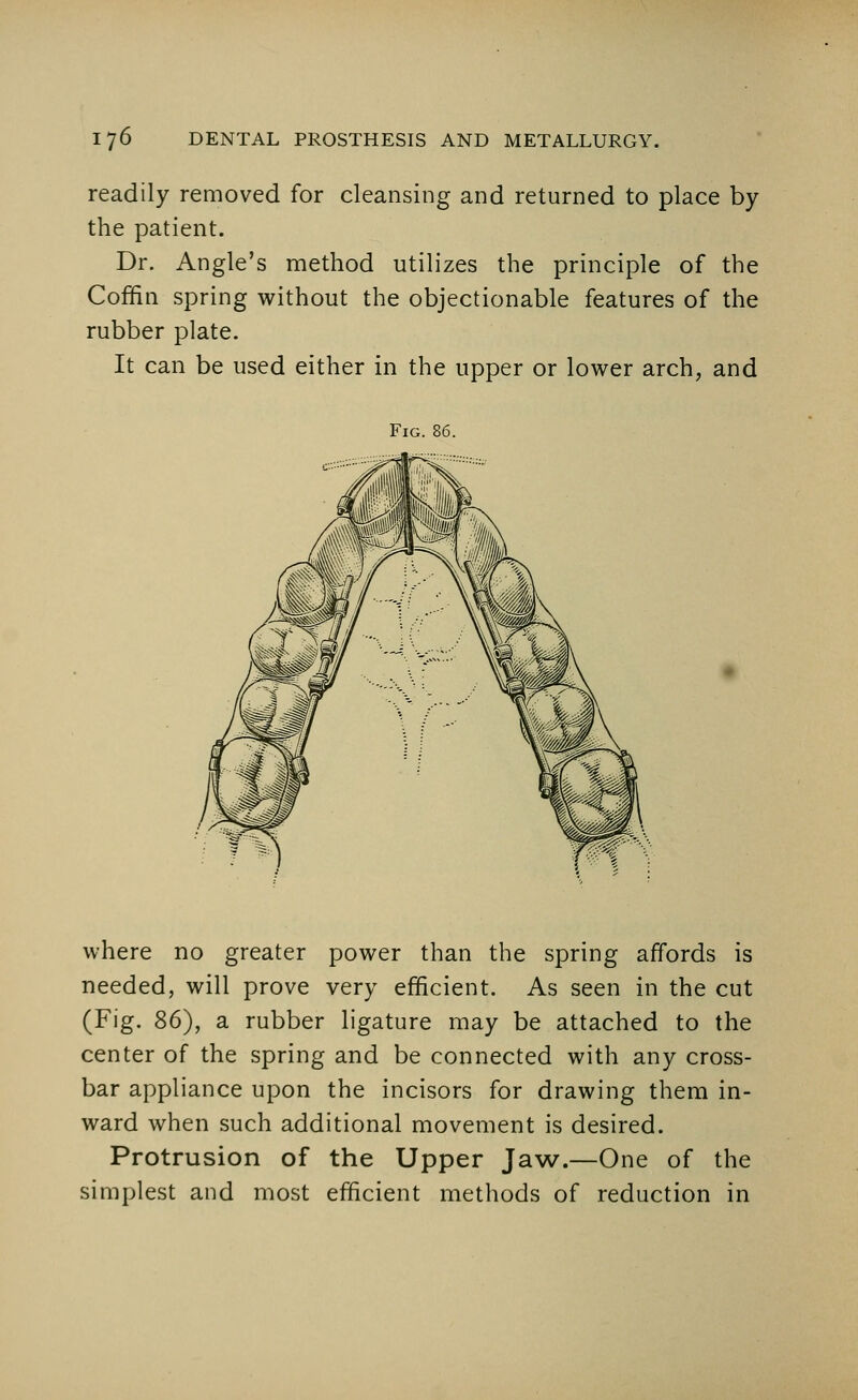 readily removed for cleansing and returned to place by the patient. Dr. Angle's method utilizes the principle of the Coffin spring without the objectionable features of the rubber plate. It can be used either in the upper or lower arch, and Fig. 86. where no greater power than the spring affords is needed, will prove very efficient. As seen in the cut (Fig. 86), a rubber ligature may be attached to the center of the spring and be connected with any cross- bar appliance upon the incisors for drawing them in- ward when such additional movement is desired. Protrusion of the Upper Jaw.—One of the simplest and most efficient methods of reduction in