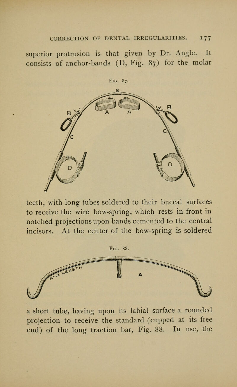 superior protrusion is that given by Dr. Angle. It consists of anchor-bands (D, Fig. 87) for the molar Fig. 87. teeth, with long tubes soldered to their buccal surfaces to receive the wire bow-spring, which rests in front in notched projections upon bands cemented to the central incisors. At the center of the bow-spring is soldered Fig. a short tube, having upon its labial surface a rounded projection to receive the standard (cupped at its free end) of the long traction bar, Fig. S8. In use, the