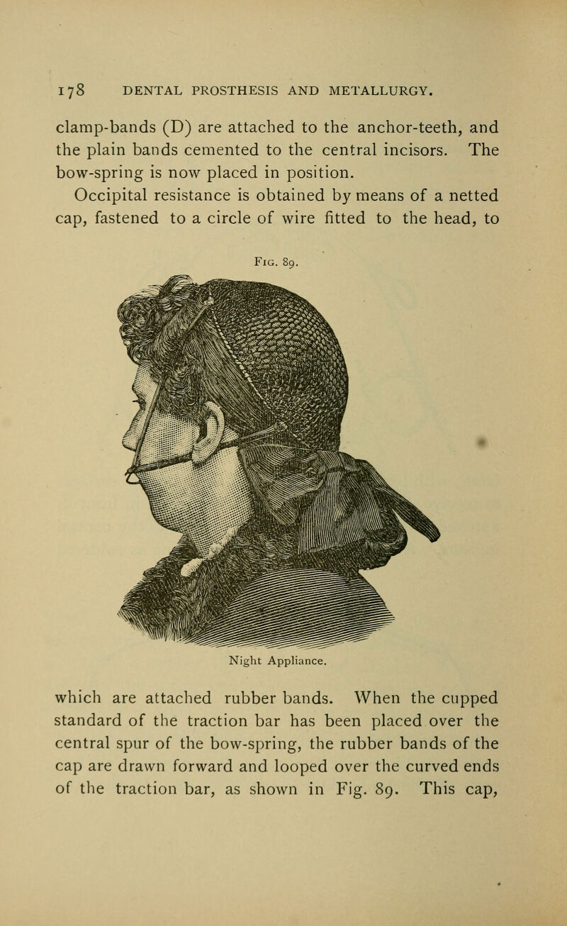 clamp-bands (D) are attached to the anchor-teeth, and the plain bands cemented to the central incisors. The bow-spring is now placed in position. Occipital resistance is obtained by means of a netted cap, fastened to a circle of wire fitted to the head, to Fig. 89. Night Appliance. which are attached rubber bands. When the cupped standard of the traction bar has been placed over the central spur of the bow-spring, the rubber bands of the cap are drawn forward and looped over the curved ends of the traction bar, as shown in Fig. 89. This cap,