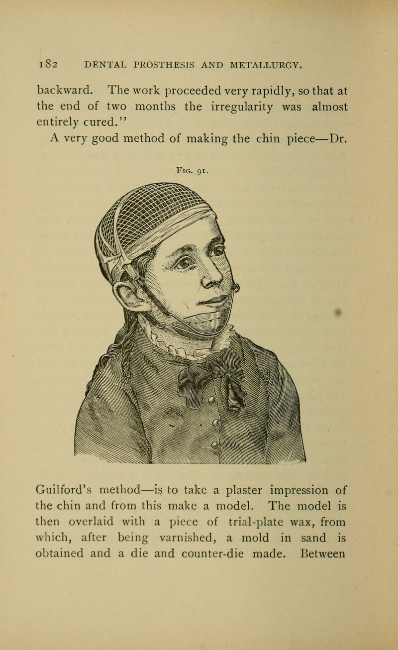 backward. The work proceeded very rapidly, so that at the end of two months the irregularity was almost entirely cured. A very good method of making the chin piece—Dr. Fig. 91 Guilford's method—is to take a plaster impression of the chin and from this make a model. The model is then overlaid with a piece of trial-plate wax, from which, after being varnished, a mold in sand is obtained and a die and counter-die made. Between