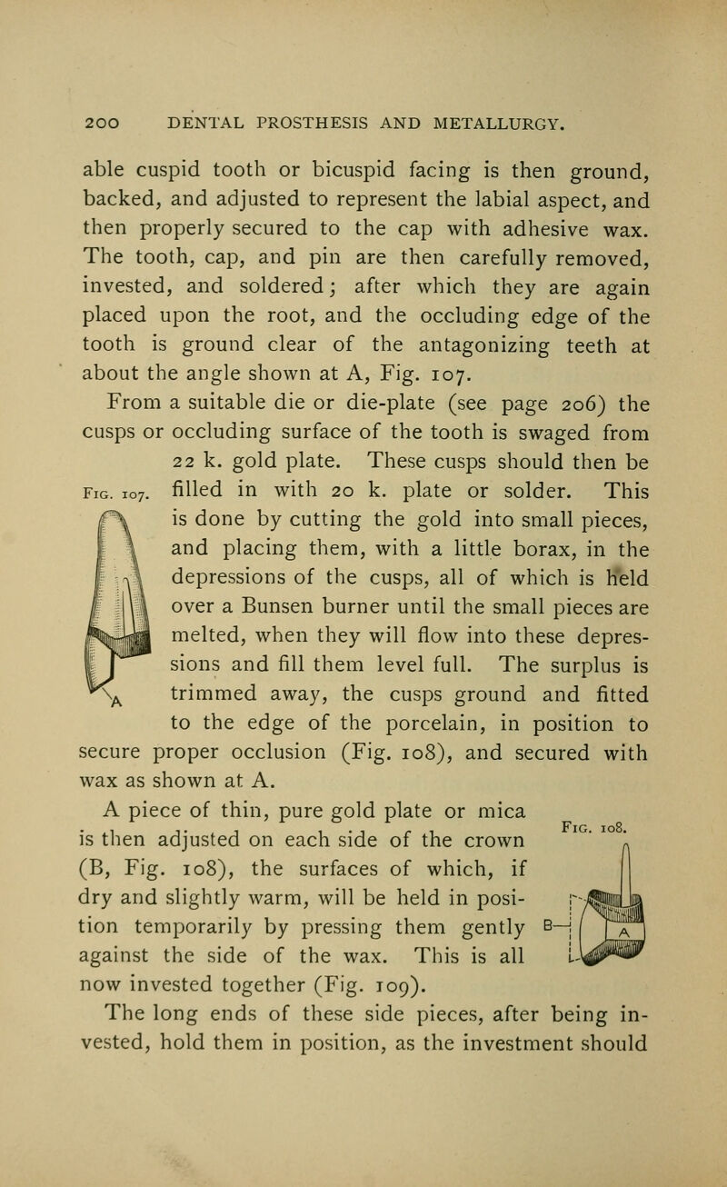 Fig. 107. able cuspid tooth or bicuspid facing is then ground, backed, and adjusted to represent the labial aspect, and then properly secured to the cap with adhesive wax. The tooth, cap, and pin are then carefully removed, invested, and soldered; after which they are again placed upon the root, and the occluding edge of the tooth is ground clear of the antagonizing teeth at about the angle shown at A, Fig. 107. From a suitable die or die-plate (see page 206) the cusps or occluding surface of the tooth is swaged from 22 k. gold plate. These cusps should then be filled in with 20 k. plate or solder. This is done by cutting the gold into small pieces, and placing them, with a little borax, in the depressions of the cusps, all of which is held over a Bunsen burner until the small pieces are melted, when they will flow into these depres- sions and fill them level full. The surplus is trimmed away, the cusps ground and fitted to the edge of the porcelain, in position to secure proper occlusion (Fig. 108), and secured with wax as shown at A. A piece of thin, pure gold plate or mica is then adjusted on each side of the crown (B, Fig. 108), the surfaces of which, if dry and slightly warm, will be held in posi- tion temporarily by pressing them gently against the side of the wax. This is all now invested together (Fig. 109). The long ends of these side pieces, after being in- vested, hold them in position, as the investment should Fig