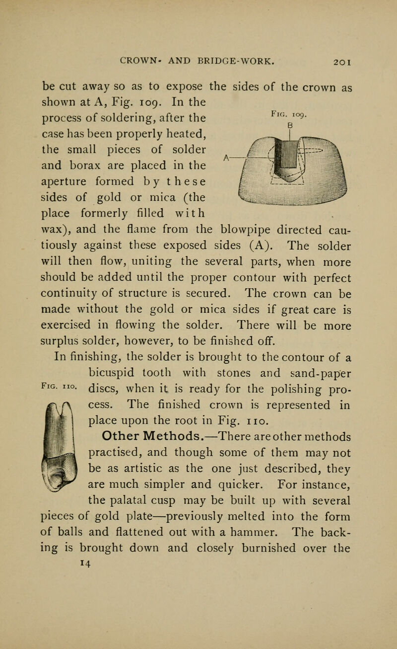 be cut away so as to expose the sides of the crown as shown at A, Fig. 109. In the process of soldering, after the case has been properly heated, the small pieces of solder and borax are placed in the aperture formed by these sides of gold or mica (the place formerly filled with wax), and the flame from the blowpipe directed cau- tiously against these exposed sides (A). The solder will then flow, uniting the several parts, when more should be added until the proper contour with perfect continuity of structure is secured. The crown can be made without the gold or mica sides if great care is exercised in flowing the solder. There will be more surplus solder, however, to be finished off. In finishing, the solder is brought to the contour of a bicuspid tooth with stones and sand-paper discs, when it is ready for the polishing pro- cess. The finished crown is represented in place upon the root in Fig. no. Other Methods.—There areother methods practised, and though some of them may not be as artistic as the one just described, they are much simpler and quicker. For instance, the palatal cusp may be built up with several pieces of gold plate—previously melted into the form of balls and flattened out with a hammer. The back- ing is brought down and closely burnished over the 14 Fig. iio.