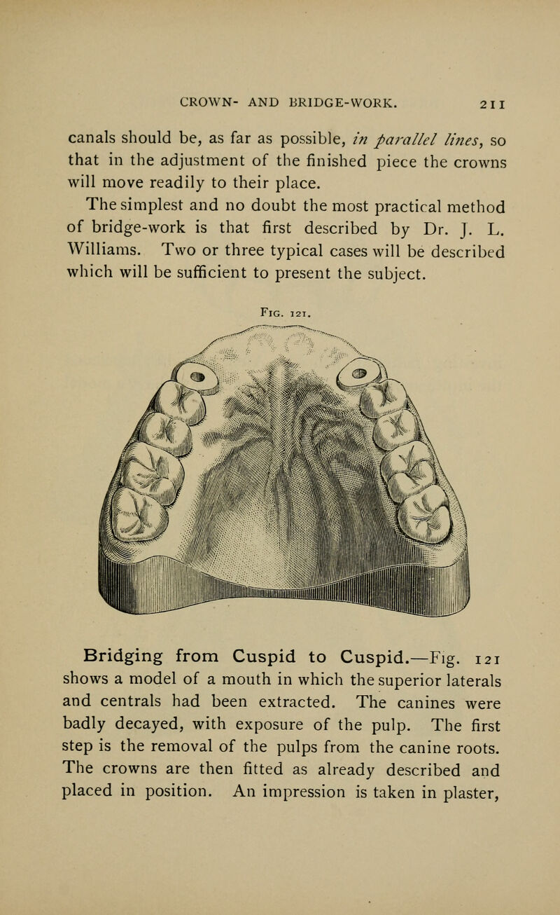 canals should be, as far as possible, in parallel lines, so that in the adjustment of the finished piece the crowns will move readily to their place. The simplest and no doubt the most practical method of bridge-work is that first described by Dr. J. L. Williams. Two or three typical cases will be described which will be sufficient to present the subject. Fig. 121. Bridging from Cuspid to Cuspid.—Fig. 121 shows a model of a mouth in which the superior laterals and centrals had been extracted. The canines were badly decayed, with exposure of the pulp. The first step is the removal of the pulps from the canine roots. The crowns are then fitted as already described and placed in position. An impression is taken in plaster,