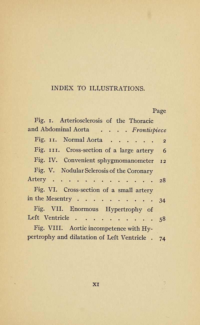 INDEX TO ILI.USTRATIONS. Page Fig. I. Arteriosclerosis of the Thoracic and Abdominal Aorta .... Frontispiece Fig. II. Normal Aorta 2 Fig. III. Cross-section of a large artery 6 Fig. IV. Convenient sphygmomanometer 12 Fig. V. Nodular Sclerosis of the Coronary Artery 28 Fig. VI. Cross-section of a small artery in the Mesentry 34 Fig. VII. Enormous Hypertrophy of Left Ventricle 58 Fig. VIII. Aortic incompetence with Hy- pertrophy and dilatation of Left Ventricle . 74