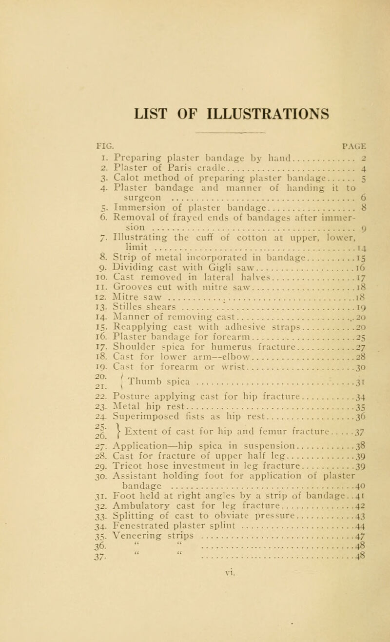 LIST OF ILLUSTRATIONS FIG. PACK 1. Preparing plaster baiulagc by liaml 2 2. Plaster of Paris cradle 4 3. Calot method of preparing plaster bandage 5 4. Plaster bandage and manner of handing it to surgeon 6 5. Immersion of plaster bandage y 6. Removal of frayed ends of bandages after immer- sion y 7. Illustrating the cuff of cotton at upper, lower, limit 14 8. Strip of metal incorporated in bandage 15 9. Dividing cast with Gigli saw 16 ID. Cast removed in lateral halves 17 11. Grooves cut with niitrc saw 18 12. Mitre saw i.S 13. Stilles shears 19 14. Manner of removing cast ..20 15. Reapplying cast with adhesive straps 20 16. Plaster bandage for forearm 25 17. Shoulder spica for humerus fracture 27 18. Cast for lower arm—elbow 28 19. Cast for forearm or wrist 30 20. / 'ri u • ^ rhumb spica 31 22. Posture applying cast lor hij) fracture 34 2;^. Metal hip rest 35 24. Superimposed fists as hip rest 36 3' > Extent of cast for hip and femur fracture ^7 27. Application—hip spica in suspension 38 28. Cast for fracture of upper half leg 39 29. Tricot hose investment in leg fracture 39 30. Assistant holding foot for application of plaster bandage 40 31. Foot held at right angles by a strip of bandage..41 ;i2. Ambulatory cast for leg fracture 42 ;ji;ii. Splitting of cast to obviate pressure 43 34. Fenestrated plaster splint 44 •5t. Veneering strips 47 36.   48 37-   48